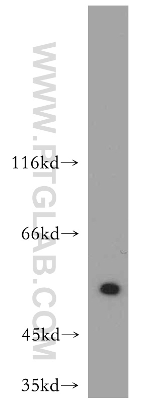 WB analysis of A431 cells using 10835-1-AP