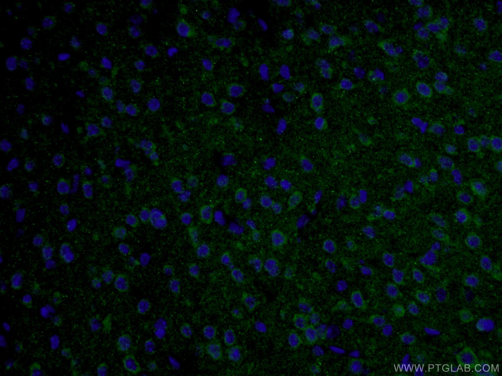 TAU antibody validated in IF