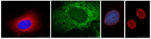 organelle marker if