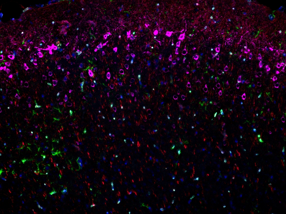 IF staining using PK10032 (Four color TSA Detect Kit for Rabbit/Mouse Primary Antibody). 
FFPE-mouse brain tissue was stained with GFAP recombinant antibody (Cat.NO. 81063-1-RR
) at 1:10000 followed by detection with Multi-rAb® Polymer HRP-Goat Anti-Rabbit/Mouse Universal Recombinant Secondary Antibody (H+L). CoraLite®Plus 488-Tyramide Reagent was used for signal development (green). The slide was then conducted HIER in pH 9.0 Tris-EDTA buffer followed by staining with MAP2 Polyclonal antibody (17490-1-AP, 1:10000). CoraLite®Plus 594-Tyramide Reagent were used for signal development (red). Similarly, WFS1 Polyclonal antibody (26995-1-AP, 1:5000) was stained subsequently. CoraLite®Plus 647-Tyramide Reagent were used for signal development (purple). Finally, cell nucleus (blue) were stained with DAPI. The signal from each channel was captured and merged. The secondaries and Tyramide reagents, as well as DAPI are all from the kit. IF staining using PK10032 (Four color TSA Detect Kit for Rabbit/Mouse Primary Antibody). 
FFPE-mouse brain tissue was stained with GFAP recombinant antibody (Cat.NO. 81063-1-RR
) at 1:10000 followed by detection with Multi-rAb® Polymer HRP-Goat Anti-Rabbit/Mouse Universal Recombinant Secondary Antibody (H+L). CoraLite®Plus 488-Tyramide Reagent was used for signal development (green). The slide was then conducted HIER in pH 9.0 Tris-EDTA buffer followed by staining with MAP2 Polyclonal antibody (17490-1-AP, 1:10000). CoraLite®Plus 594-Tyramide Reagent were used for signal development (red). Similarly, WFS1 Polyclonal antibody (26995-1-AP, 1:5000) was stained subsequently. CoraLite®Plus 647-Tyramide Reagent were used for signal development (purple). Finally, cell nucleus (blue) were stained with DAPI. The signal from each channel was captured and merged. The secondaries and Tyramide reagents, as well as DAPI are all from the kit.