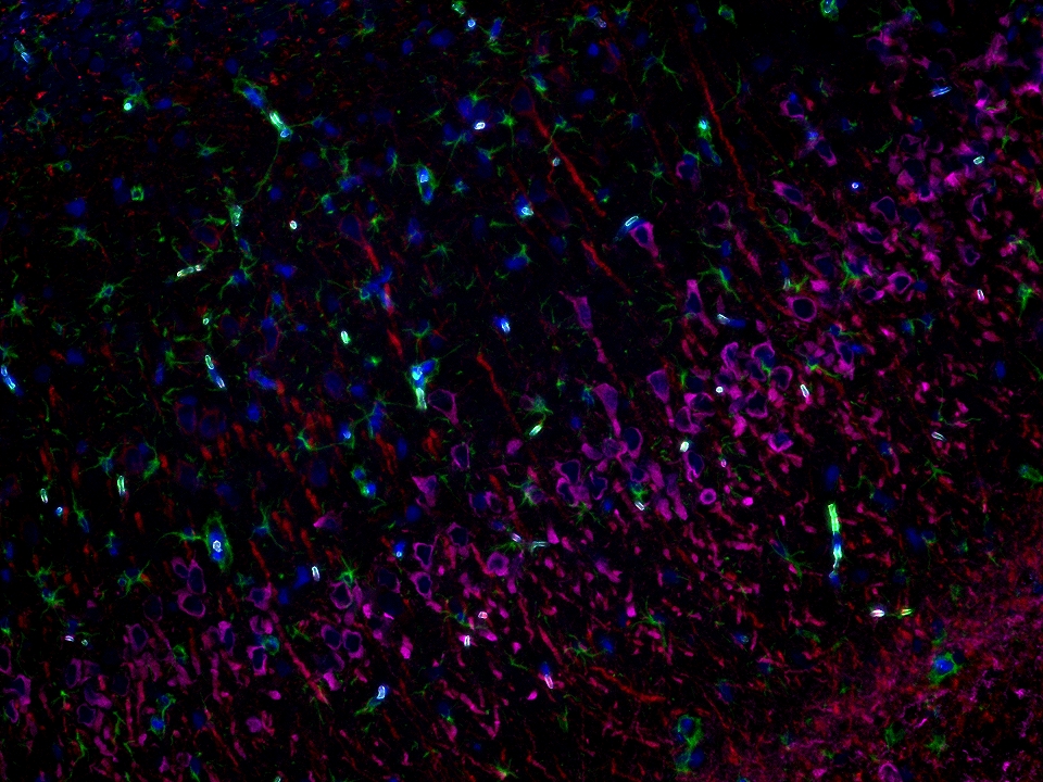 IF staining using PK10032 (Four color TSA Detect Kit for Rabbit/Mouse Primary Antibody). 
FFPE-rat brain tissue was stained with GFAP recombinant antibody (Cat.NO. 81063-1-RR) at 1:10000 followed by detection with Multi-rAb® Polymer HRP-Goat Anti-Rabbit/Mouse Universal Recombinant Secondary Antibody (H+L). CoraLite®Plus 488-Tyramide Reagent  was used for signal development (green). The slide was then conducted HIER in pH 9.0 Tris-EDTA buffer followed by staining with MAP2 Polyclonal antibody (17490-1-AP, 1:10000). CoraLite®Plus 594-Tyramide Reagent were used for signal development (red). Similarly, WFS1 Polyclonal antibody (26995-1-AP, 1:5000) was stained subsequently. CoraLite®Plus 647-Tyramide Reagent were used for signal development (purple). Finally, cell nucleus (blue) were stained with DAPI. The signal from each channel was captured and merged. The secondaries and Tyramide reagents, as well as DAPI are all from the kit. IF staining using PK10032 (Four color TSA Detect Kit for Rabbit/Mouse Primary Antibody). 
FFPE-rat brain tissue was stained with GFAP recombinant antibody (Cat.NO. 81063-1-RR) at 1:10000 followed by detection with Multi-rAb® Polymer HRP-Goat Anti-Rabbit/Mouse Universal Recombinant Secondary Antibody (H+L). CoraLite®Plus 488-Tyramide Reagent  was used for signal development (green). The slide was then conducted HIER in pH 9.0 Tris-EDTA buffer followed by staining with MAP2 Polyclonal antibody (17490-1-AP, 1:10000). CoraLite®Plus 594-Tyramide Reagent were used for signal development (red). Similarly, WFS1 Polyclonal antibody (26995-1-AP, 1:5000) was stained subsequently. CoraLite®Plus 647-Tyramide Reagent were used for signal development (purple). Finally, cell nucleus (blue) were stained with DAPI. The signal from each channel was captured and merged. The secondaries and Tyramide reagents, as well as DAPI are all from the kit.