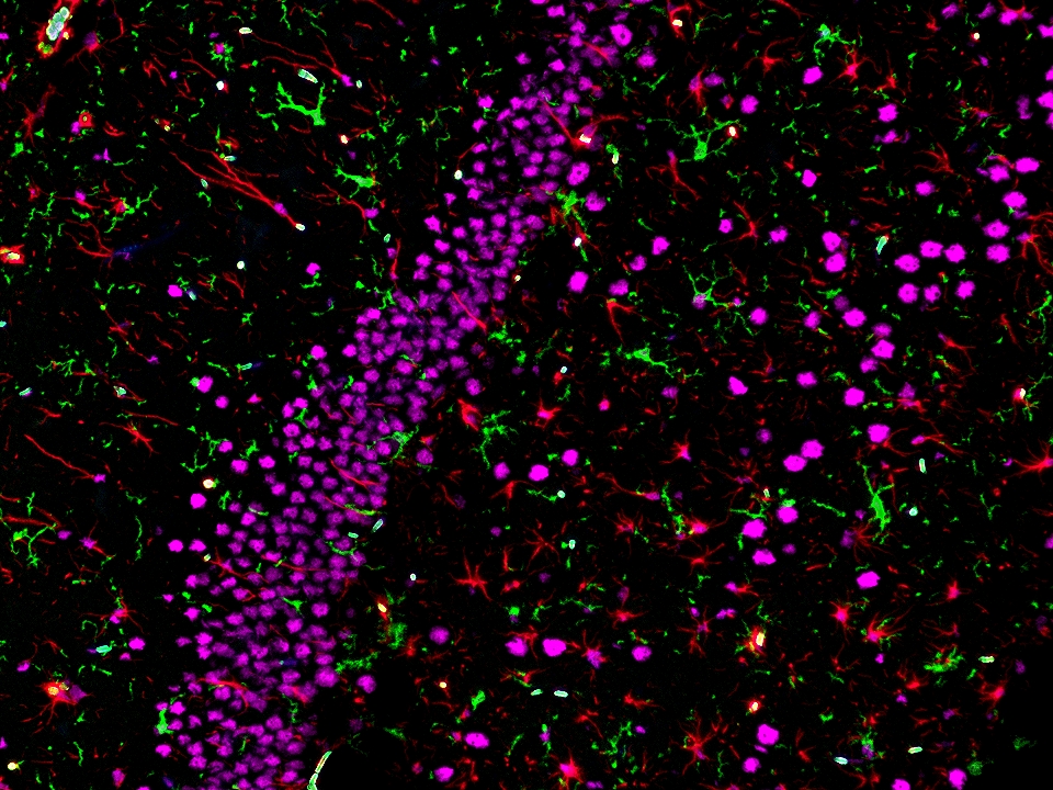 IF staining using PK10032 (Four color TSA Detect Kit for Rabbit/Mouse Primary Antibody). 
FFPE-rat brain tissue was stained with IBA1 recombinant antibody (Cat.NO. 81728-1-RR ) at 1:2000 followed by detection with Multi-rAb® Polymer HRP-Goat Anti-Rabbit/Mouse Universal Recombinant Secondary Antibody (H+L). CoraLite®Plus 488-Tyramide Reagent was used for signal development (green). The slide was then conducted HIER in pH 9.0 Tris-EDTA buffer followed by staining with GFAP monoclonal antibody (60190-1-Ig, 1:20000). CoraLite®Plus 594-Tyramide Reagent were used for signal development (red). Similarly, TDP-43 recombinant antibody (80002-1-RR, 1:3200) was stained subsequently. CoraLite®Plus 647-Tyramide Reagent were used for signal development (purple). Finally, cell nucleus (blue) were stained with DAPI. The signal from each channel was captured and merged. The secondaries and Tyramide reagents, as well as DAPI are all from the kit. IF staining using PK10032 (Four color TSA Detect Kit for Rabbit/Mouse Primary Antibody). 
FFPE-rat brain tissue was stained with IBA1 recombinant antibody (Cat.NO. 81728-1-RR ) at 1:2000 followed by detection with Multi-rAb® Polymer HRP-Goat Anti-Rabbit/Mouse Universal Recombinant Secondary Antibody (H+L). CoraLite®Plus 488-Tyramide Reagent was used for signal development (green). The slide was then conducted HIER in pH 9.0 Tris-EDTA buffer followed by staining with GFAP monoclonal antibody (60190-1-Ig, 1:20000). CoraLite®Plus 594-Tyramide Reagent were used for signal development (red). Similarly, TDP-43 recombinant antibody (80002-1-RR, 1:3200) was stained subsequently. CoraLite®Plus 647-Tyramide Reagent were used for signal development (purple). Finally, cell nucleus (blue) were stained with DAPI. The signal from each channel was captured and merged. The secondaries and Tyramide reagents, as well as DAPI are all from the kit.