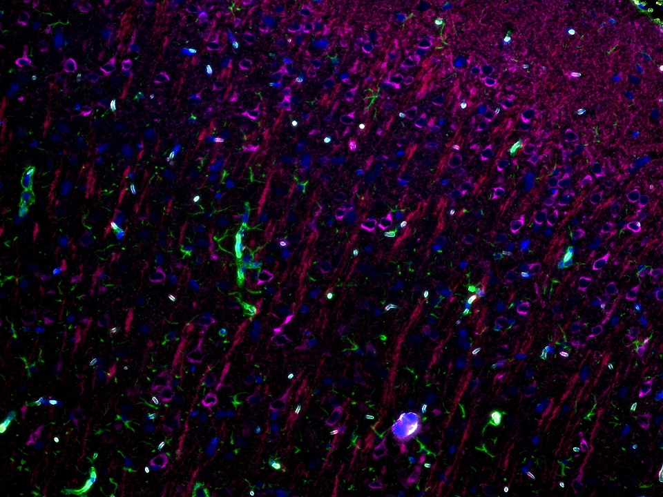 IF staining using PK10033 (Four Detect Kit for Rabbit Primary Antibody). 
FFPE-mouse brain tissue was stained with GFAP recombinant antibody (Cat.NO. 81063-1-RR) at 1:10000 followed by detection with Multi-rAb® Polymer HRP-Goat Anti-Rabbit Recombinant Secondary Antibody (H+L). CoraLite®Plus 488-Tyramide Reagent  was used for signal development (green). The slide was then conducted HIER in pH 9.0 Tris-EDTA buffer followed by staining with MAP2 Polyclonal antibody (17490-1-AP, 1:10000). CoraLite®Plus 594-Tyramide Reagent were used for signal development (red). Similarly, WFS1 Polyclonal antibody (26995-1-AP, 1:5000) was stained subsequently. CoraLite®Plus 647-Tyramide Reagent were used for signal development (purple). Finally, cell nucleus (blue) were stained with DAPI. The signal from each channel was captured and merged. The secondaries and Tyramide reagents, as well as DAPI are all from the kit. IF staining using PK10033 (Four Detect Kit for Rabbit Primary Antibody). 
FFPE-mouse brain tissue was stained with GFAP recombinant antibody (Cat.NO. 81063-1-RR) at 1:10000 followed by detection with Multi-rAb® Polymer HRP-Goat Anti-Rabbit Recombinant Secondary Antibody (H+L). CoraLite®Plus 488-Tyramide Reagent  was used for signal development (green). The slide was then conducted HIER in pH 9.0 Tris-EDTA buffer followed by staining with MAP2 Polyclonal antibody (17490-1-AP, 1:10000). CoraLite®Plus 594-Tyramide Reagent were used for signal development (red). Similarly, WFS1 Polyclonal antibody (26995-1-AP, 1:5000) was stained subsequently. CoraLite®Plus 647-Tyramide Reagent were used for signal development (purple). Finally, cell nucleus (blue) were stained with DAPI. The signal from each channel was captured and merged. The secondaries and Tyramide reagents, as well as DAPI are all from the kit.