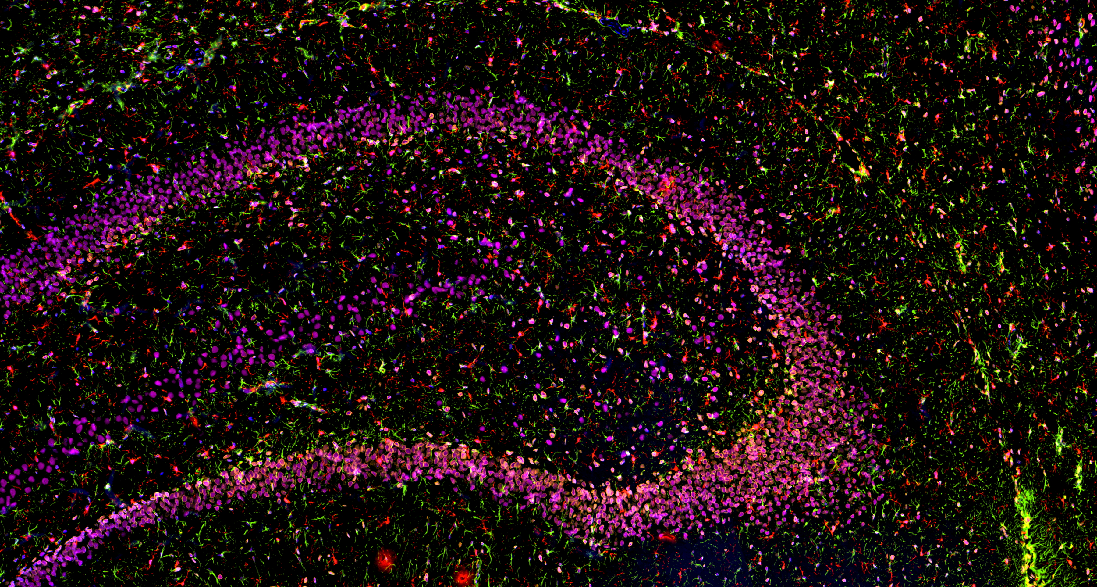 IF staining using PK10034 (Five color TSA Detect Kit for Rabbit/Mouse Primary Antibody).
FFPE-rat brain tissue was stained with Lamin B1 monoclonal antibody (Cat.NO. 66095-1-Ig) at 1:2000 followed by detection with Multi-rAb® Polymer HRP-Goat Anti-Rabbit/Mouse Universal Recombinant Secondary Antibody (H+L). CoraLite®Plus 555-Tyramide Reagent was used for signal development (yellow). The slide was then conducted HIER in pH 9.0 Tris-EDTA buffer followed by staining with GFAP monoclonal antibody (60190-1-Ig, 1:20000). CoraLite®Plus 488-Tyramide Reagent were used for signal development (green). Similarly, IBA1 recombinant antibody (81728-1-RR, 1:2000) TDP-43 recombinant antibody (80002-1-RR, 1:3200) were stained subsequently. CoraLite®Plus 594-Tyramide Reagent (red) and CoraLite®Plus 647-Tyramide Reagent (purple) were used for signal development respectively. Finally, cell nucleus (blue) were stained with DAPI. The signal from each channel was captured and merged. IF staining using PK10034 (Five color TSA Detect Kit for Rabbit/Mouse Primary Antibody).
FFPE-rat brain tissue was stained with Lamin B1 monoclonal antibody (Cat.NO. 66095-1-Ig) at 1:2000 followed by detection with Multi-rAb® Polymer HRP-Goat Anti-Rabbit/Mouse Universal Recombinant Secondary Antibody (H+L). CoraLite®Plus 555-Tyramide Reagent was used for signal development (yellow). The slide was then conducted HIER in pH 9.0 Tris-EDTA buffer followed by staining with GFAP monoclonal antibody (60190-1-Ig, 1:20000). CoraLite®Plus 488-Tyramide Reagent were used for signal development (green). Similarly, IBA1 recombinant antibody (81728-1-RR, 1:2000) TDP-43 recombinant antibody (80002-1-RR, 1:3200) were stained subsequently. CoraLite®Plus 594-Tyramide Reagent (red) and CoraLite®Plus 647-Tyramide Reagent (purple) were used for signal development respectively. Finally, cell nucleus (blue) were stained with DAPI. The signal from each channel was captured and merged.