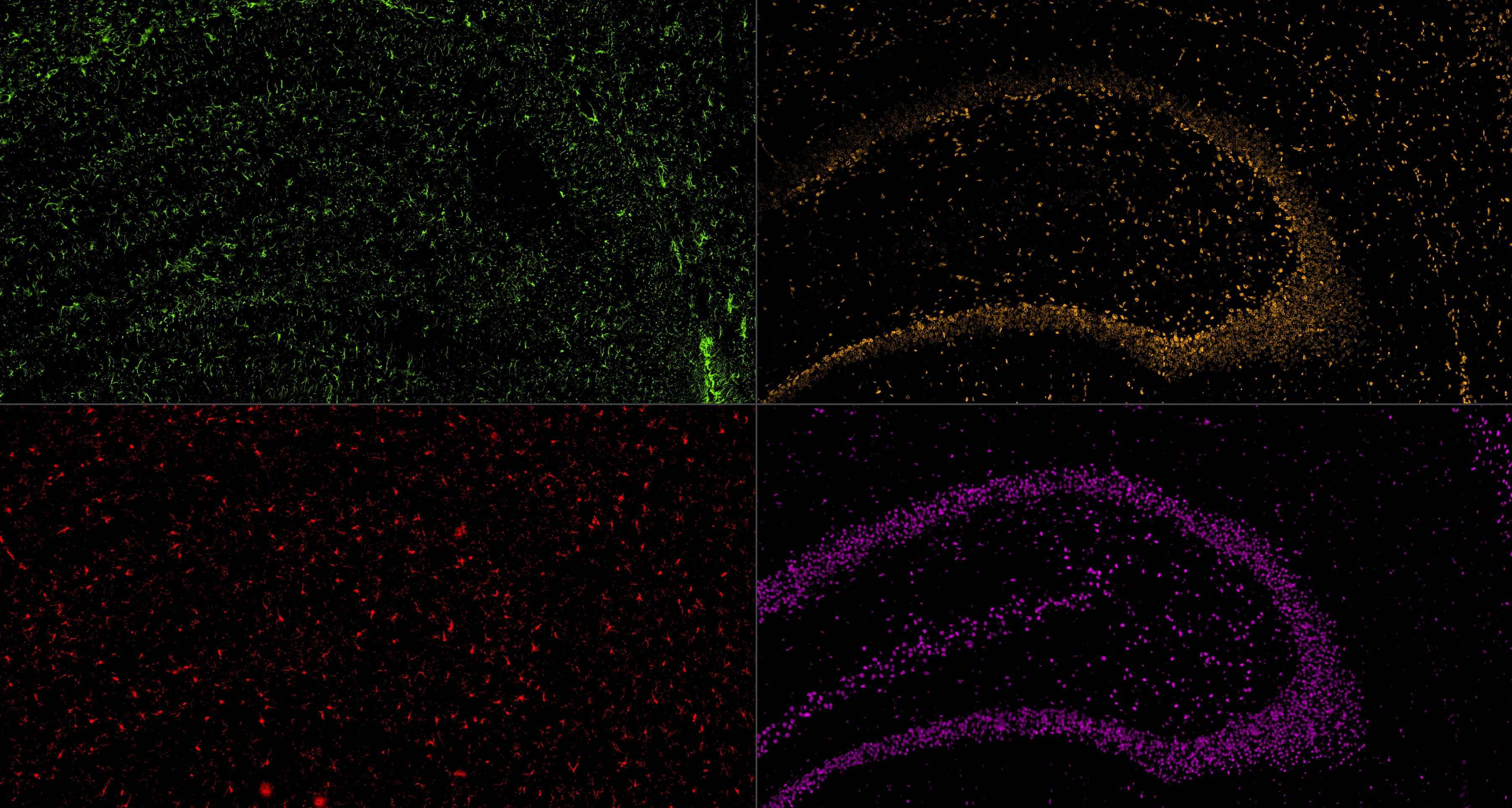 IF staining using PK10034 (Five color TSA Detect Kit for Rabbit/Mouse Primary Antibody).
FFPE-rat brain tissue was stained with Lamin B1 monoclonal antibody (Cat.NO. 66095-1-Ig) at 1:2000 followed by detection with Multi-rAb® Polymer HRP-Goat Anti-Rabbit/Mouse Universal Recombinant Secondary Antibody (H+L). CoraLite®Plus 555-Tyramide Reagent was used for signal development (yellow). The slide was then conducted HIER in pH 9.0 Tris-EDTA buffer followed by staining with GFAP monoclonal antibody (60190-1-Ig, 1:20000). CoraLite®Plus 488-Tyramide Reagent were used for signal development (green). Similarly, IBA1 recombinant antibody (81728-1-RR, 1:2000) TDP-43 recombinant antibody (80002-1-RR, 1:3200) were stained subsequently. CoraLite®Plus 594-Tyramide Reagent (red) and CoraLite®Plus 647-Tyramide Reagent (purple) were used for signal development respectively. Finally, cell nucleus (blue) were stained with DAPI. IF staining using PK10034 (Five color TSA Detect Kit for Rabbit/Mouse Primary Antibody).
FFPE-rat brain tissue was stained with Lamin B1 monoclonal antibody (Cat.NO. 66095-1-Ig) at 1:2000 followed by detection with Multi-rAb® Polymer HRP-Goat Anti-Rabbit/Mouse Universal Recombinant Secondary Antibody (H+L). CoraLite®Plus 555-Tyramide Reagent was used for signal development (yellow). The slide was then conducted HIER in pH 9.0 Tris-EDTA buffer followed by staining with GFAP monoclonal antibody (60190-1-Ig, 1:20000). CoraLite®Plus 488-Tyramide Reagent were used for signal development (green). Similarly, IBA1 recombinant antibody (81728-1-RR, 1:2000) TDP-43 recombinant antibody (80002-1-RR, 1:3200) were stained subsequently. CoraLite®Plus 594-Tyramide Reagent (red) and CoraLite®Plus 647-Tyramide Reagent (purple) were used for signal development respectively. Finally, cell nucleus (blue) were stained with DAPI.