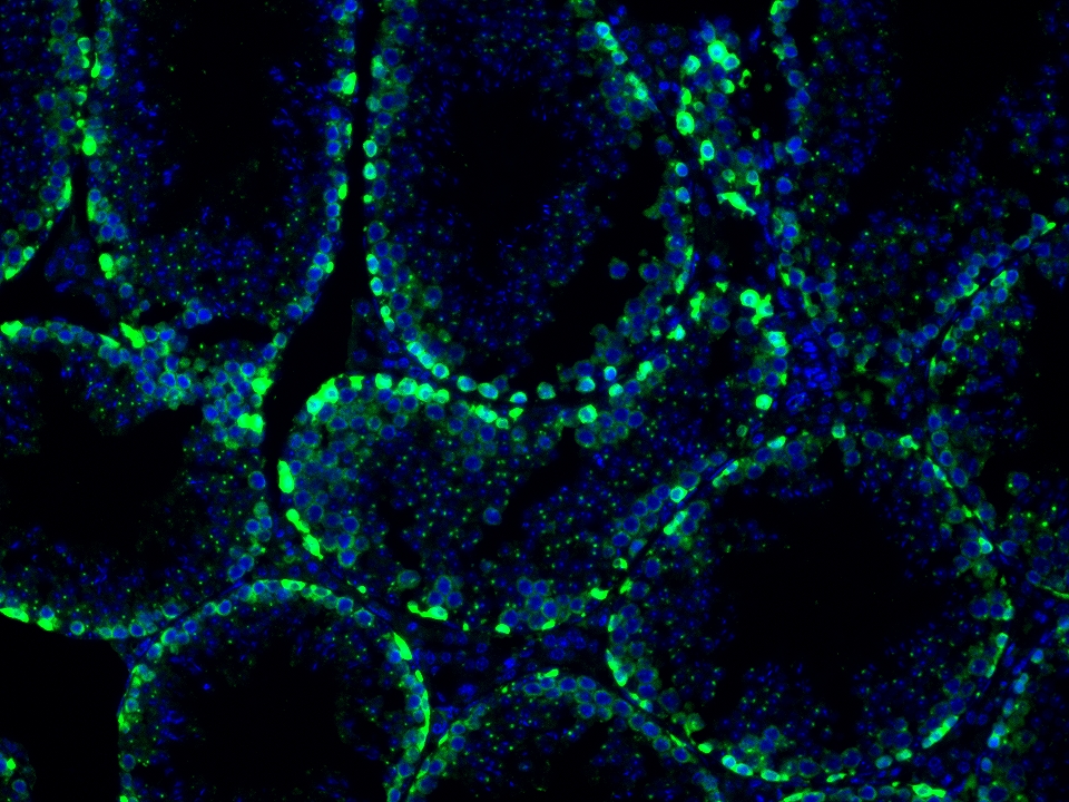 IF Staining using CoraLite®Plus 488-Tyramide Reagent PR30022. 
FFPE-mouse testis tissue was stained with 26718-1-AP (DUSP9 polyclonal antibody) at 1:500 followed by detection with Multi-rAb® Polymer HRP-Goat Anti-Rabbit/Mouse Universal Recombinant Secondary Antibody (H+L) (Cat.NO. RGAU011). CoraLite®Plus 488-Tyramide Reagent (Cat.NO. PR30022) was used for signal development. Cell nucleus (blue) was stained with DAPI. IF Staining using CoraLite®Plus 488-Tyramide Reagent PR30022. 
FFPE-mouse testis tissue was stained with 26718-1-AP (DUSP9 polyclonal antibody) at 1:500 followed by detection with Multi-rAb® Polymer HRP-Goat Anti-Rabbit/Mouse Universal Recombinant Secondary Antibody (H+L) (Cat.NO. RGAU011). CoraLite®Plus 488-Tyramide Reagent (Cat.NO. PR30022) was used for signal development. Cell nucleus (blue) was stained with DAPI.