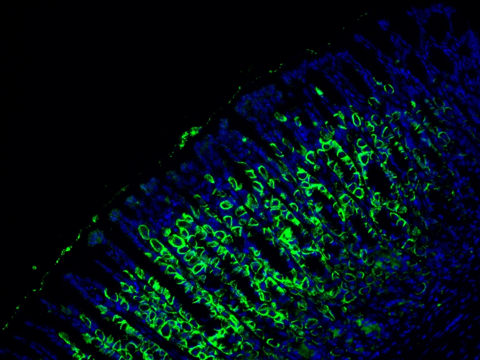 IF Staining using CoraLite®Plus 488-Tyramide Reagent PR30022. 
FFPE-rat stomach tissue was stained with 10182-1-AP (DCTN5 polyclonal antibody) at 1:200 followed by detection with Multi-rAb® Polymer HRP-Goat Anti-Rabbit/Mouse Universal Recombinant Secondary Antibody (H+L) (Cat.NO. RGAU011). CoraLite®Plus 488-Tyramide Reagent (Cat.NO. PR30022) was used for signal development. Cell nucleus (blue) was stained with DAPI. IF Staining using CoraLite®Plus 488-Tyramide Reagent PR30022. 
FFPE-rat stomach tissue was stained with 10182-1-AP (DCTN5 polyclonal antibody) at 1:200 followed by detection with Multi-rAb® Polymer HRP-Goat Anti-Rabbit/Mouse Universal Recombinant Secondary Antibody (H+L) (Cat.NO. RGAU011). CoraLite®Plus 488-Tyramide Reagent (Cat.NO. PR30022) was used for signal development. Cell nucleus (blue) was stained with DAPI.