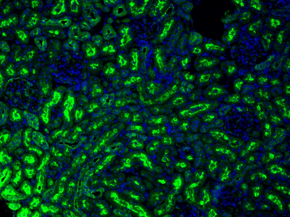 IF Staining using CoraLite®Plus 488-Tyramide Reagent PR30022. 
FFPE-rat kidney tissue was stained with 27334-1-AP (IFT74 polyclonal antibody) at 1:500 followed by detection with Multi-rAb® Polymer HRP-Goat Anti-Rabbit/Mouse Universal Recombinant Secondary Antibody (H+L) (Cat.NO. RGAU011). CoraLite®Plus 488-Tyramide Reagent (Cat.NO. PR30022) was used for signal development. Cell nucleus (blue) was stained with DAPI. IF Staining using CoraLite®Plus 488-Tyramide Reagent PR30022. 
FFPE-rat kidney tissue was stained with 27334-1-AP (IFT74 polyclonal antibody) at 1:500 followed by detection with Multi-rAb® Polymer HRP-Goat Anti-Rabbit/Mouse Universal Recombinant Secondary Antibody (H+L) (Cat.NO. RGAU011). CoraLite®Plus 488-Tyramide Reagent (Cat.NO. PR30022) was used for signal development. Cell nucleus (blue) was stained with DAPI.