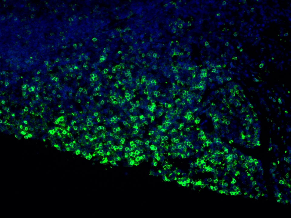 IF Staining using CoraLite®Plus 488-Tyramide Reagent PR30022. 
FFPE-human appendicitis tissue was stained with 65150-1-Ig (CD45RO Monoclonal antibody) at 1:10000 followed by detection with Multi-rAb® Polymer HRP-Goat Anti-Rabbit/Mouse Universal Recombinant Secondary Antibody (H+L) (Cat.NO. RGAU011). CoraLite®Plus 488-Tyramide Reagent (Cat.NO. PR30022) was used for signal development. Cell nucleus (blue) was stained with DAPI. IF Staining using CoraLite®Plus 488-Tyramide Reagent PR30022. 
FFPE-human appendicitis tissue was stained with 65150-1-Ig (CD45RO Monoclonal antibody) at 1:10000 followed by detection with Multi-rAb® Polymer HRP-Goat Anti-Rabbit/Mouse Universal Recombinant Secondary Antibody (H+L) (Cat.NO. RGAU011). CoraLite®Plus 488-Tyramide Reagent (Cat.NO. PR30022) was used for signal development. Cell nucleus (blue) was stained with DAPI.