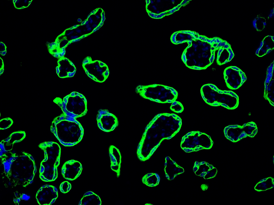 IF Staining using CoraLite®Plus 488-Tyramide Reagent PR30022. 
FFPE-human placenta tissue was stained with 30031-1-AP (SLC43A2 polyclonal antibody) at 1:500 followed by detection with Multi-rAb® Polymer HRP-Goat Anti-Rabbit/Mouse Universal Recombinant Secondary Antibody (H+L) (Cat.NO. RGAU011). CoraLite®Plus 488-Tyramide Reagent (Cat.NO. PR30022) was used for signal development. Cell nucleus (blue) was stained with DAPI. IF Staining using CoraLite®Plus 488-Tyramide Reagent PR30022. 
FFPE-human placenta tissue was stained with 30031-1-AP (SLC43A2 polyclonal antibody) at 1:500 followed by detection with Multi-rAb® Polymer HRP-Goat Anti-Rabbit/Mouse Universal Recombinant Secondary Antibody (H+L) (Cat.NO. RGAU011). CoraLite®Plus 488-Tyramide Reagent (Cat.NO. PR30022) was used for signal development. Cell nucleus (blue) was stained with DAPI.