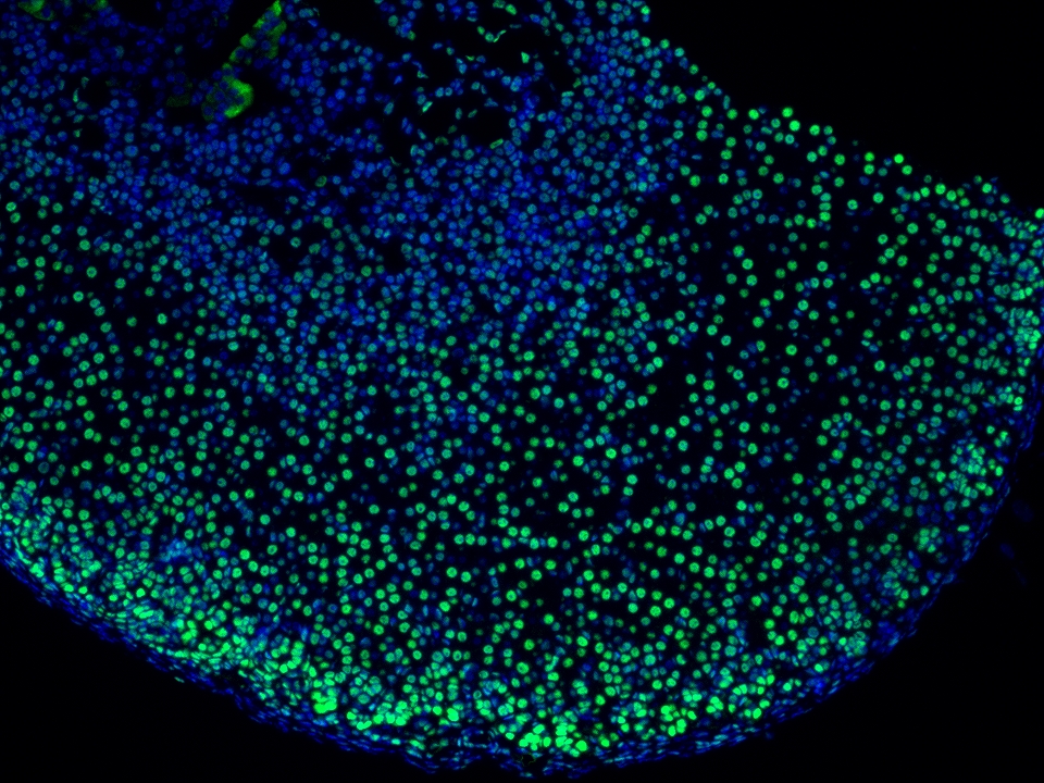 IF Staining using CoraLite®Plus 488-Tyramide Reagent PR30022. 
FFPE-mouse adrenal gland tissue was stained with 82979-6-RR (ARID1B Recombinant antibody) at 1:16000 followed by detection with Multi-rAb® Polymer HRP-Goat Anti-Rabbit/Mouse Universal Recombinant Secondary Antibody (H+L) (Cat.NO. RGAU011). CoraLite®Plus 488-Tyramide Reagent (Cat.NO. PR30022) was used for signal development. Cell nucleus (blue) was stained with DAPI. IF Staining using CoraLite®Plus 488-Tyramide Reagent PR30022. 
FFPE-mouse adrenal gland tissue was stained with 82979-6-RR (ARID1B Recombinant antibody) at 1:16000 followed by detection with Multi-rAb® Polymer HRP-Goat Anti-Rabbit/Mouse Universal Recombinant Secondary Antibody (H+L) (Cat.NO. RGAU011). CoraLite®Plus 488-Tyramide Reagent (Cat.NO. PR30022) was used for signal development. Cell nucleus (blue) was stained with DAPI.