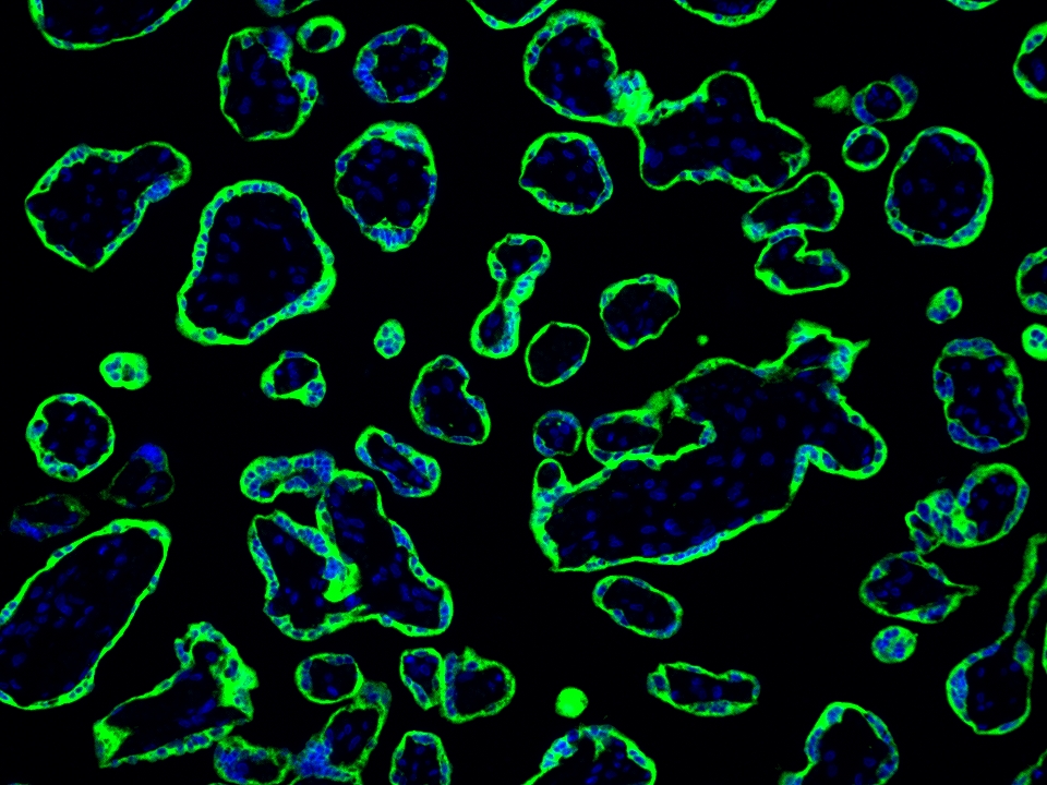 IF Staining using CoraLite®Plus 488-Tyramide Reagent PR30022. 
FFPE-human placenta tissue was stained with 83755-2-RR (RNF139 Recombinant antibody) at 1:2000 followed by detection with Multi-rAb® Polymer HRP-Goat Anti-Rabbit/Mouse Universal Recombinant Secondary Antibody (H+L) (Cat.NO. RGAU011). CoraLite®Plus 488-Tyramide Reagent (Cat.NO. PR30022) was used for signal development. Cell nucleus (blue) was stained with DAPI. IF Staining using CoraLite®Plus 488-Tyramide Reagent PR30022. 
FFPE-human placenta tissue was stained with 83755-2-RR (RNF139 Recombinant antibody) at 1:2000 followed by detection with Multi-rAb® Polymer HRP-Goat Anti-Rabbit/Mouse Universal Recombinant Secondary Antibody (H+L) (Cat.NO. RGAU011). CoraLite®Plus 488-Tyramide Reagent (Cat.NO. PR30022) was used for signal development. Cell nucleus (blue) was stained with DAPI.
