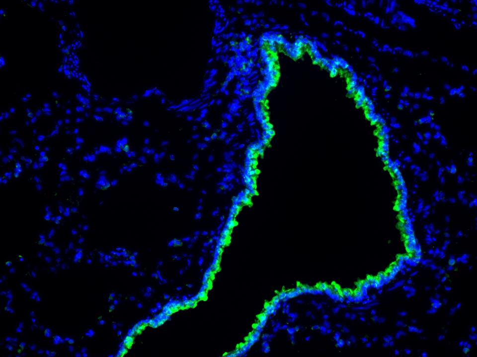 IF Staining using CoraLite®Plus 488-Tyramide Reagent PR30022. 
FFPE-rat lung tissue was stained with 67623-1-Ig (DIS3L2 Monoclonal antibody) at 1:4000 followed by detection with Multi-rAb® Polymer HRP-Goat Anti-Rabbit/Mouse Universal Recombinant Secondary Antibody (H+L) (Cat.NO. RGAU011). CoraLite®Plus 488-Tyramide Reagent (Cat.NO. PR30022) was used for signal development. Cell nucleus (blue) was stained with DAPI. IF Staining using CoraLite®Plus 488-Tyramide Reagent PR30022. 
FFPE-rat lung tissue was stained with 67623-1-Ig (DIS3L2 Monoclonal antibody) at 1:4000 followed by detection with Multi-rAb® Polymer HRP-Goat Anti-Rabbit/Mouse Universal Recombinant Secondary Antibody (H+L) (Cat.NO. RGAU011). CoraLite®Plus 488-Tyramide Reagent (Cat.NO. PR30022) was used for signal development. Cell nucleus (blue) was stained with DAPI.