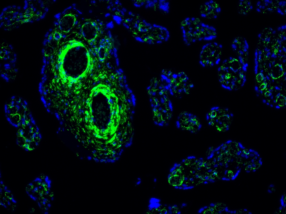 IF Staining using CoraLite®Plus 488-Tyramide Reagent PR30022. 
FFPE-human placenta tissue was stained with 67882-1-Ig (LPCAT3 Monoclonal antibody) at 1:1000 followed by detection with Multi-rAb® Polymer HRP-Goat Anti-Rabbit/Mouse Universal Recombinant Secondary Antibody (H+L) (Cat.NO. RGAU011). CoraLite®Plus 488-Tyramide Reagent (Cat.NO. PR30022) was used for signal development. Cell nucleus (blue) was stained with DAPI. IF Staining using CoraLite®Plus 488-Tyramide Reagent PR30022. 
FFPE-human placenta tissue was stained with 67882-1-Ig (LPCAT3 Monoclonal antibody) at 1:1000 followed by detection with Multi-rAb® Polymer HRP-Goat Anti-Rabbit/Mouse Universal Recombinant Secondary Antibody (H+L) (Cat.NO. RGAU011). CoraLite®Plus 488-Tyramide Reagent (Cat.NO. PR30022) was used for signal development. Cell nucleus (blue) was stained with DAPI.