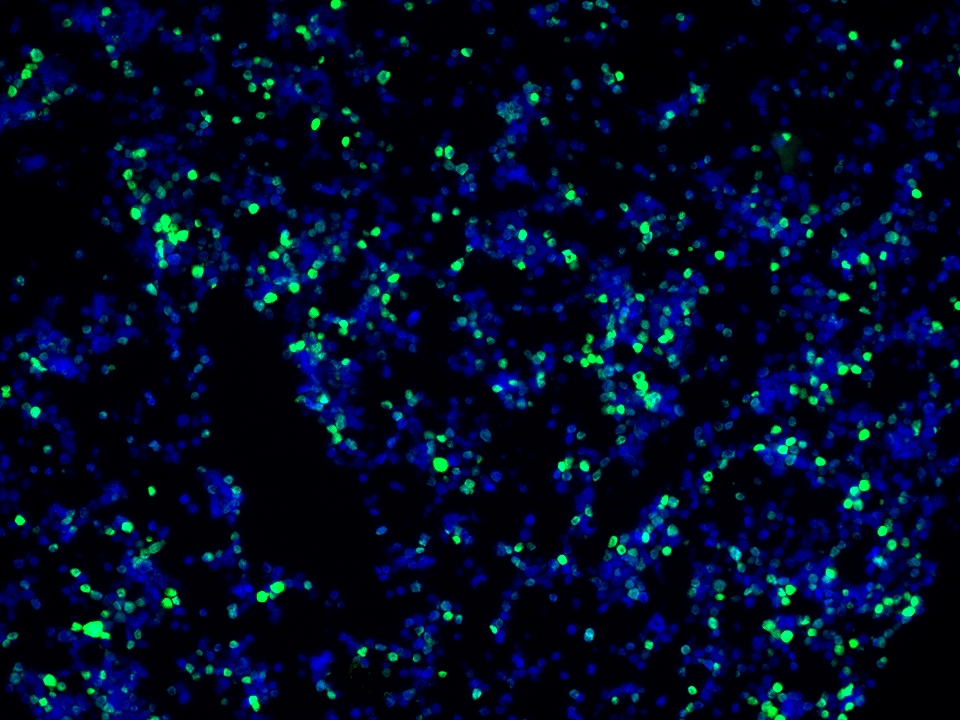 IF Staining using CoraLite®Plus 488-Tyramide Reagent PR30022. 
FFPE-MJ cells was stained with 68803-2-Ig (FOXP3 Monoclonal antibody) at 1:2000 followed by detection with Multi-rAb® Polymer HRP-Goat Anti-Rabbit/Mouse Universal Recombinant Secondary Antibody (H+L) (Cat.NO. RGAU011). CoraLite®Plus 488-Tyramide Reagent (Cat.NO. PR30022) was used for signal development. Cell nucleus (blue) was stained with DAPI. IF Staining using CoraLite®Plus 488-Tyramide Reagent PR30022. 
FFPE-MJ cells was stained with 68803-2-Ig (FOXP3 Monoclonal antibody) at 1:2000 followed by detection with Multi-rAb® Polymer HRP-Goat Anti-Rabbit/Mouse Universal Recombinant Secondary Antibody (H+L) (Cat.NO. RGAU011). CoraLite®Plus 488-Tyramide Reagent (Cat.NO. PR30022) was used for signal development. Cell nucleus (blue) was stained with DAPI.