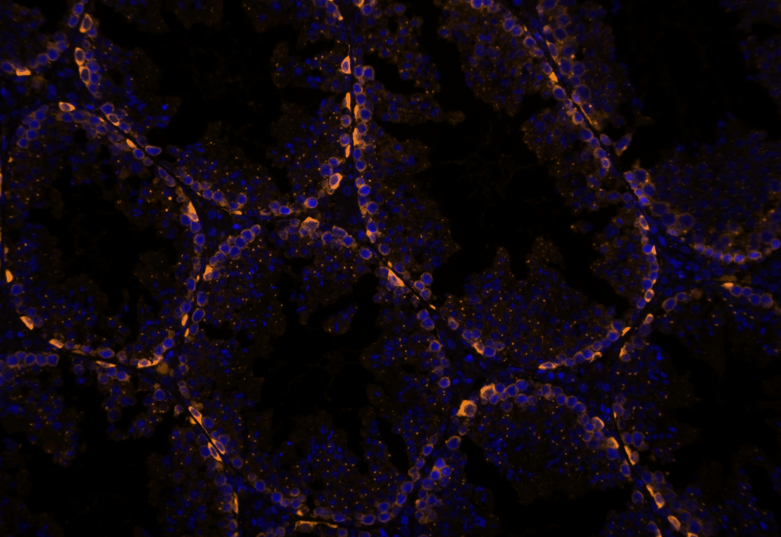 IF Staining using CoraLite®Plus 555-Tyramide Reagent PR30023. 
FFPE-mouse testis tissue was stained with 26718-1-AP (DUSP9 polyclonal antibody) at 1:500 followed by detection with Multi-rAb® Polymer HRP-Goat Anti-Rabbit/Mouse Universal Recombinant Secondary Antibody (H+L) (Cat.NO. RGAU011). CoraLite®Plus 555-Tyramide Reagent (Cat.NO. PR30023) was used for signal development. Cell nucleus (blue) was stained with DAPI. IF Staining using CoraLite®Plus 555-Tyramide Reagent PR30023. 
FFPE-mouse testis tissue was stained with 26718-1-AP (DUSP9 polyclonal antibody) at 1:500 followed by detection with Multi-rAb® Polymer HRP-Goat Anti-Rabbit/Mouse Universal Recombinant Secondary Antibody (H+L) (Cat.NO. RGAU011). CoraLite®Plus 555-Tyramide Reagent (Cat.NO. PR30023) was used for signal development. Cell nucleus (blue) was stained with DAPI.