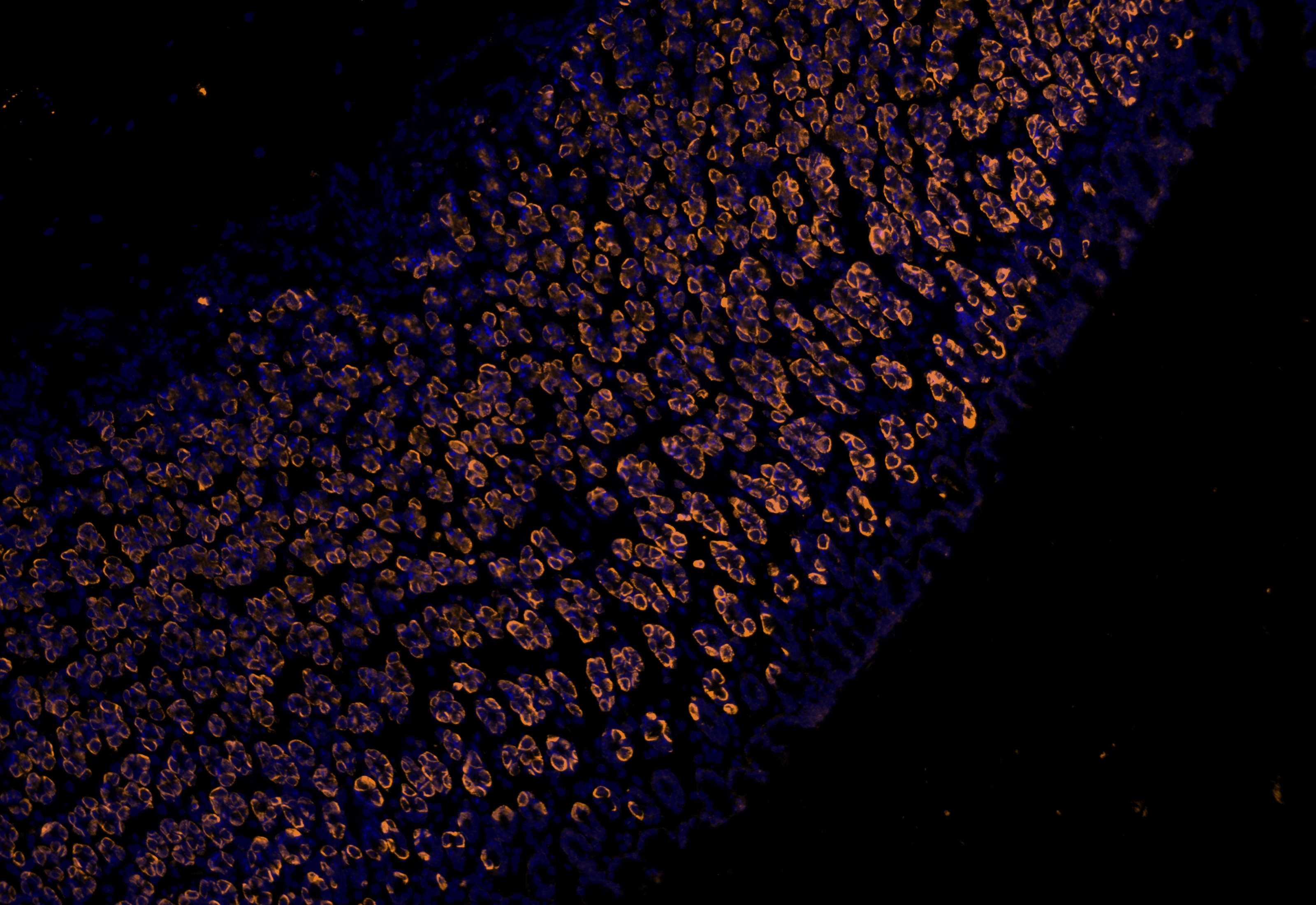 IF Staining using CoraLite®Plus 555-Tyramide Reagent PR30023. 
FFPE-rat stomach tissue was stained with 10182-1-AP (DCTN5 polyclonal antibody) at 1:200 followed by detection with Multi-rAb® Polymer HRP-Goat Anti-Rabbit/Mouse Universal Recombinant Secondary Antibody (H+L) (Cat.NO. RGAU011). CoraLite®Plus 555-Tyramide Reagent (Cat.NO. PR30023) was used for signal development. Cell nucleus (blue) was stained with DAPI. IF Staining using CoraLite®Plus 555-Tyramide Reagent PR30023. 
FFPE-rat stomach tissue was stained with 10182-1-AP (DCTN5 polyclonal antibody) at 1:200 followed by detection with Multi-rAb® Polymer HRP-Goat Anti-Rabbit/Mouse Universal Recombinant Secondary Antibody (H+L) (Cat.NO. RGAU011). CoraLite®Plus 555-Tyramide Reagent (Cat.NO. PR30023) was used for signal development. Cell nucleus (blue) was stained with DAPI.