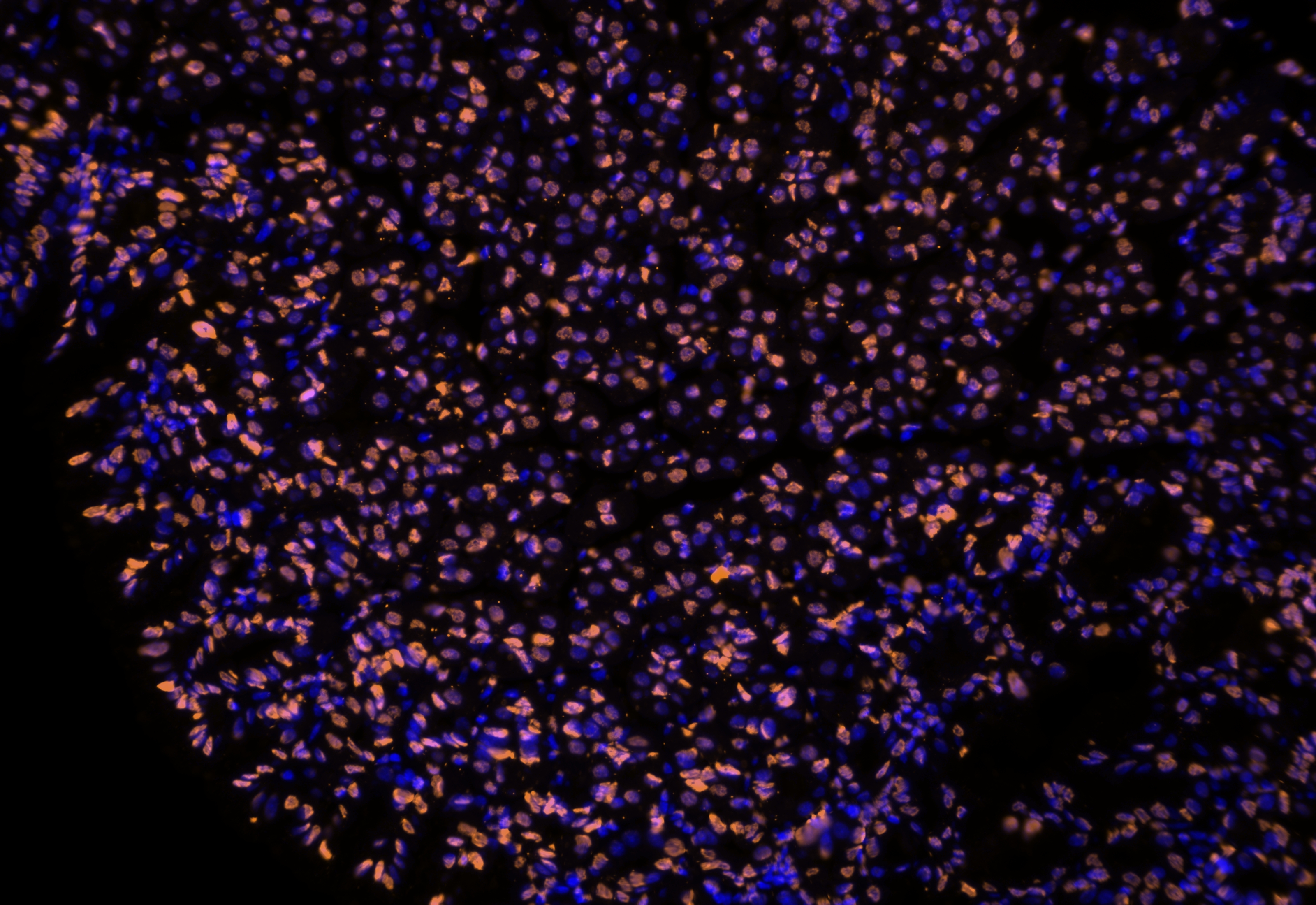 IF Staining using CoraLite®Plus 555-Tyramide Reagent PR30023. 
FFPE-mouse stomach tissue was stained with 82823-2-RR (Acetyl-Histone H2A (Lys9) Recombinant antibody) at 1:1000 followed by detection with Multi-rAb® Polymer HRP-Goat Anti-Rabbit/Mouse Universal Recombinant Secondary Antibody (H+L) (Cat.NO. RGAU011). CoraLite®Plus 555-Tyramide Reagent (Cat.NO. PR30023) was used for signal development. Cell nucleus (blue) was stained with DAPI. IF Staining using CoraLite®Plus 555-Tyramide Reagent PR30023. 
FFPE-mouse stomach tissue was stained with 82823-2-RR (Acetyl-Histone H2A (Lys9) Recombinant antibody) at 1:1000 followed by detection with Multi-rAb® Polymer HRP-Goat Anti-Rabbit/Mouse Universal Recombinant Secondary Antibody (H+L) (Cat.NO. RGAU011). CoraLite®Plus 555-Tyramide Reagent (Cat.NO. PR30023) was used for signal development. Cell nucleus (blue) was stained with DAPI.
