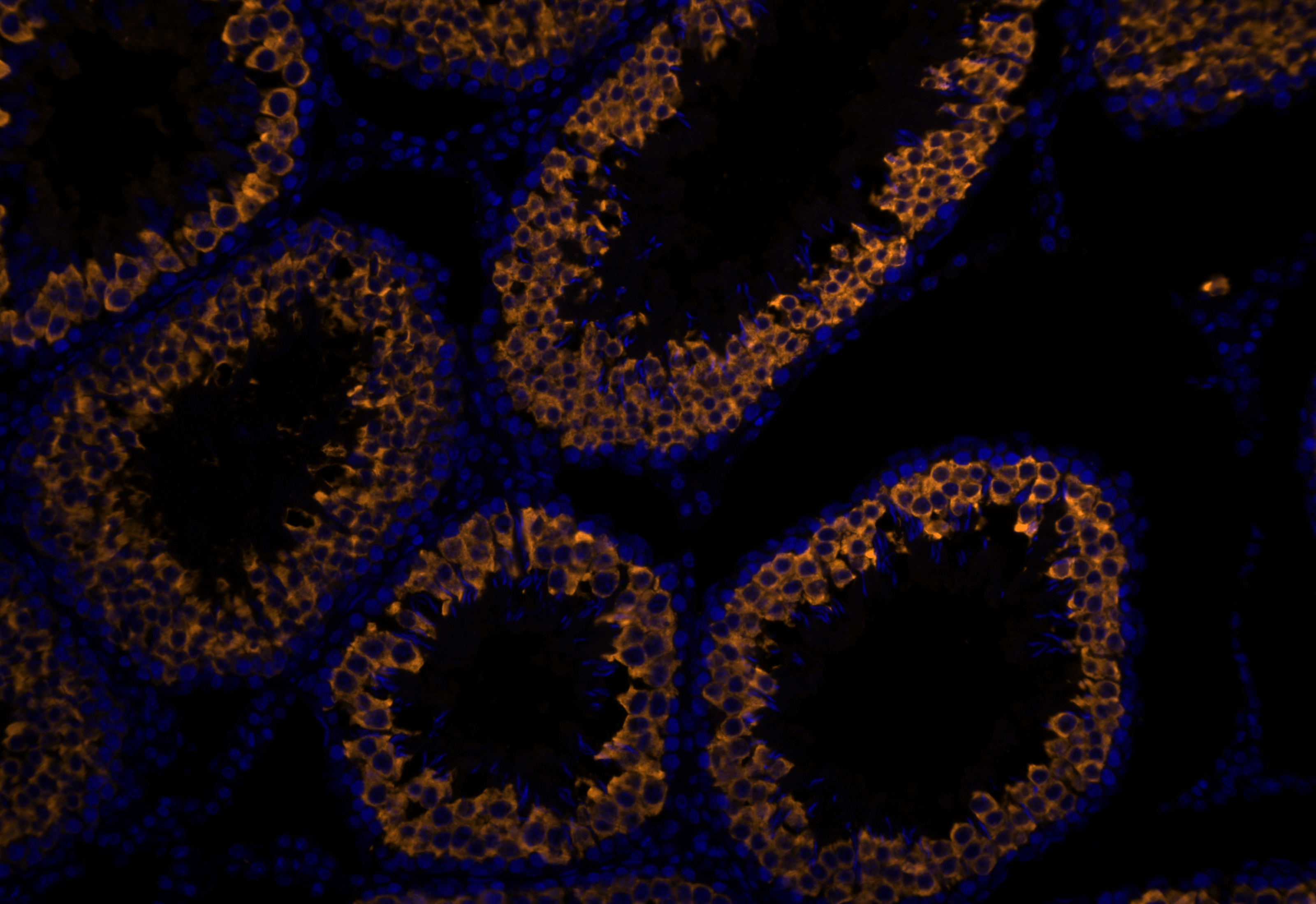IF Staining using CoraLite®Plus 555-Tyramide Reagent PR30023. 
FFPE-rat testis tissue was stained with 13720-1-AP (BOULE polyclonal antibody) at 1:2000 followed by detection with Multi-rAb® Polymer HRP-Goat Anti-Rabbit/Mouse Universal Recombinant Secondary Antibody (H+L) (Cat.NO. RGAU011). CoraLite®Plus 555-Tyramide Reagent (Cat.NO. PR30023) was used for signal development. Cell nucleus (blue) was stained with DAPI. IF Staining using CoraLite®Plus 555-Tyramide Reagent PR30023. 
FFPE-rat testis tissue was stained with 13720-1-AP (BOULE polyclonal antibody) at 1:2000 followed by detection with Multi-rAb® Polymer HRP-Goat Anti-Rabbit/Mouse Universal Recombinant Secondary Antibody (H+L) (Cat.NO. RGAU011). CoraLite®Plus 555-Tyramide Reagent (Cat.NO. PR30023) was used for signal development. Cell nucleus (blue) was stained with DAPI.