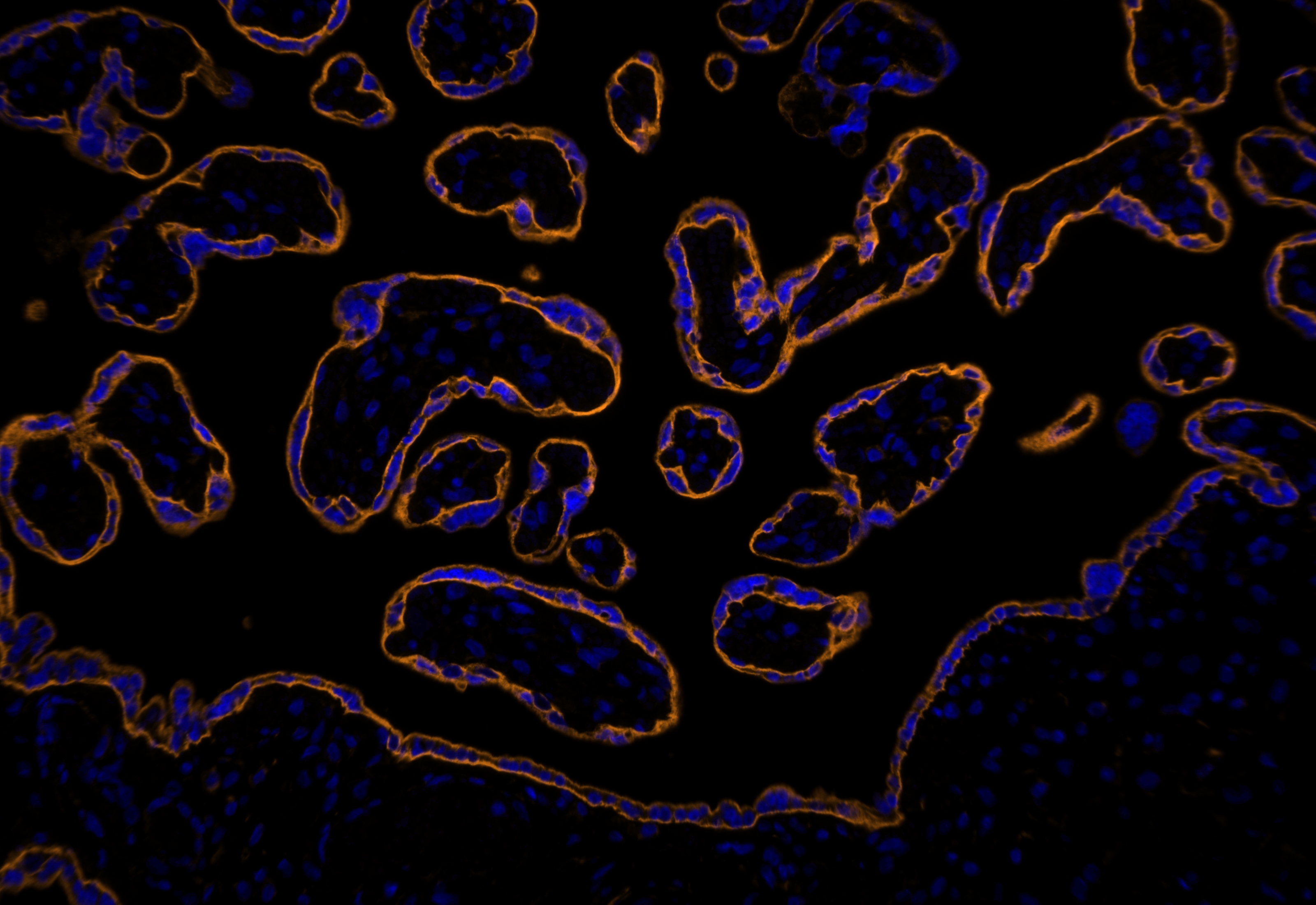 IF Staining using CoraLite®Plus 555-Tyramide Reagent PR30023. 
FFPE-human placenta tissue was stained with 30031-1-AP (SLC43A2 polyclonal antibody) at 1:500 followed by detection with Multi-rAb® Polymer HRP-Goat Anti-Rabbit/Mouse Universal Recombinant Secondary Antibody (H+L) (Cat.NO. RGAU011). CoraLite®Plus 555-Tyramide Reagent (Cat.NO. PR30023) was used for signal development. Cell nucleus (blue) was stained with DAPI. IF Staining using CoraLite®Plus 555-Tyramide Reagent PR30023. 
FFPE-human placenta tissue was stained with 30031-1-AP (SLC43A2 polyclonal antibody) at 1:500 followed by detection with Multi-rAb® Polymer HRP-Goat Anti-Rabbit/Mouse Universal Recombinant Secondary Antibody (H+L) (Cat.NO. RGAU011). CoraLite®Plus 555-Tyramide Reagent (Cat.NO. PR30023) was used for signal development. Cell nucleus (blue) was stained with DAPI.