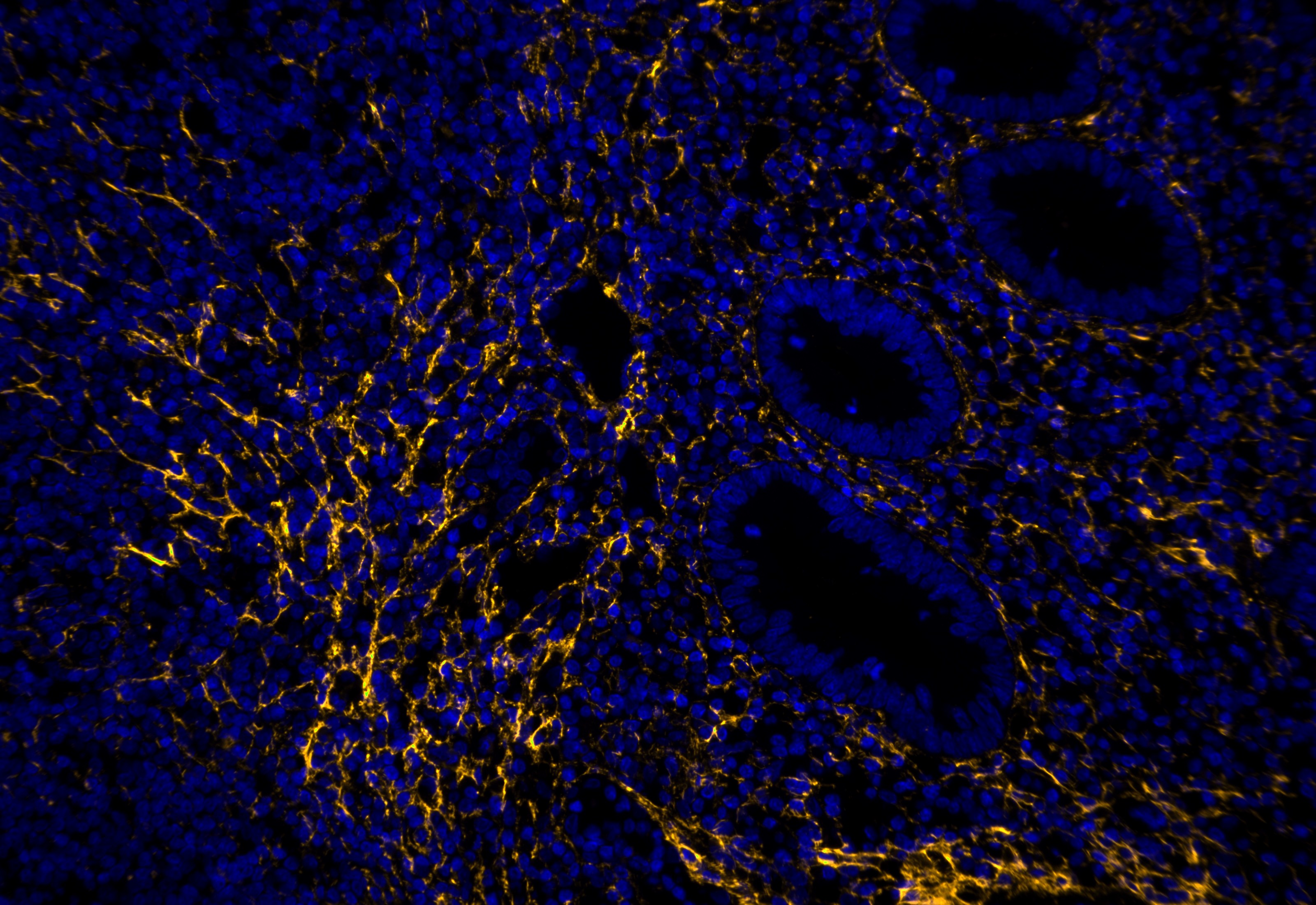 IF Staining using CoraLite®Plus 555-Tyramide Reagent PR30023. 
FFPE-human appendicitis tissue was stained with 67288-1-Ig (Collagen Type I Monoclonal antibody) at 1:4000 followed by detection with Multi-rAb® Polymer HRP-Goat Anti-Rabbit/Mouse Universal Recombinant Secondary Antibody (H+L) (Cat.NO. RGAU011). CoraLite®Plus 555-Tyramide Reagent (Cat.NO. PR30023) was used for signal development. Cell nucleus (blue) was stained with DAPI.  IF Staining using CoraLite®Plus 555-Tyramide Reagent PR30023. 
FFPE-human appendicitis tissue was stained with 67288-1-Ig (Collagen Type I Monoclonal antibody) at 1:4000 followed by detection with Multi-rAb® Polymer HRP-Goat Anti-Rabbit/Mouse Universal Recombinant Secondary Antibody (H+L) (Cat.NO. RGAU011). CoraLite®Plus 555-Tyramide Reagent (Cat.NO. PR30023) was used for signal development. Cell nucleus (blue) was stained with DAPI.