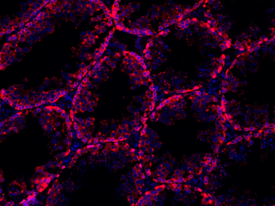 IF Staining using CoraLite®Plus 594-Tyramide Reagent PR30024. 
FFPE-mouse testis tissue was stained with 26718-1-AP (DUSP9 polyclonal antibody) at 1:500 followed by detection with Multi-rAb® Polymer HRP-Goat Anti-Rabbit/Mouse Universal Recombinant Secondary Antibody (H+L) (Cat.NO. RGAU011). CoraLite®Plus 594-Tyramide Reagent (Cat.NO. PR30024) was used for signal development. Cell nucleus (blue) was stained with DAPI. IF Staining using CoraLite®Plus 594-Tyramide Reagent PR30024. 
FFPE-mouse testis tissue was stained with 26718-1-AP (DUSP9 polyclonal antibody) at 1:500 followed by detection with Multi-rAb® Polymer HRP-Goat Anti-Rabbit/Mouse Universal Recombinant Secondary Antibody (H+L) (Cat.NO. RGAU011). CoraLite®Plus 594-Tyramide Reagent (Cat.NO. PR30024) was used for signal development. Cell nucleus (blue) was stained with DAPI.