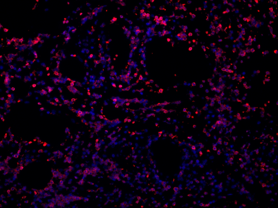 IF Staining using CoraLite®Plus 594-Tyramide Reagent PR30024. 
FFPE-human appendicitis tissue was stained with 65150-1-Ig (CD45RO Monoclonal antibody) at 1:10000 followed by detection with Multi-rAb® Polymer HRP-Goat Anti-Rabbit/Mouse Universal Recombinant Secondary Antibody (H+L) (Cat.NO. RGAU011). CoraLite®Plus 594-Tyramide Reagent (Cat.NO. PR30024) was used for signal development. Cell nucleus (blue) was stained with DAPI. IF Staining using CoraLite®Plus 594-Tyramide Reagent PR30024. 
FFPE-human appendicitis tissue was stained with 65150-1-Ig (CD45RO Monoclonal antibody) at 1:10000 followed by detection with Multi-rAb® Polymer HRP-Goat Anti-Rabbit/Mouse Universal Recombinant Secondary Antibody (H+L) (Cat.NO. RGAU011). CoraLite®Plus 594-Tyramide Reagent (Cat.NO. PR30024) was used for signal development. Cell nucleus (blue) was stained with DAPI.