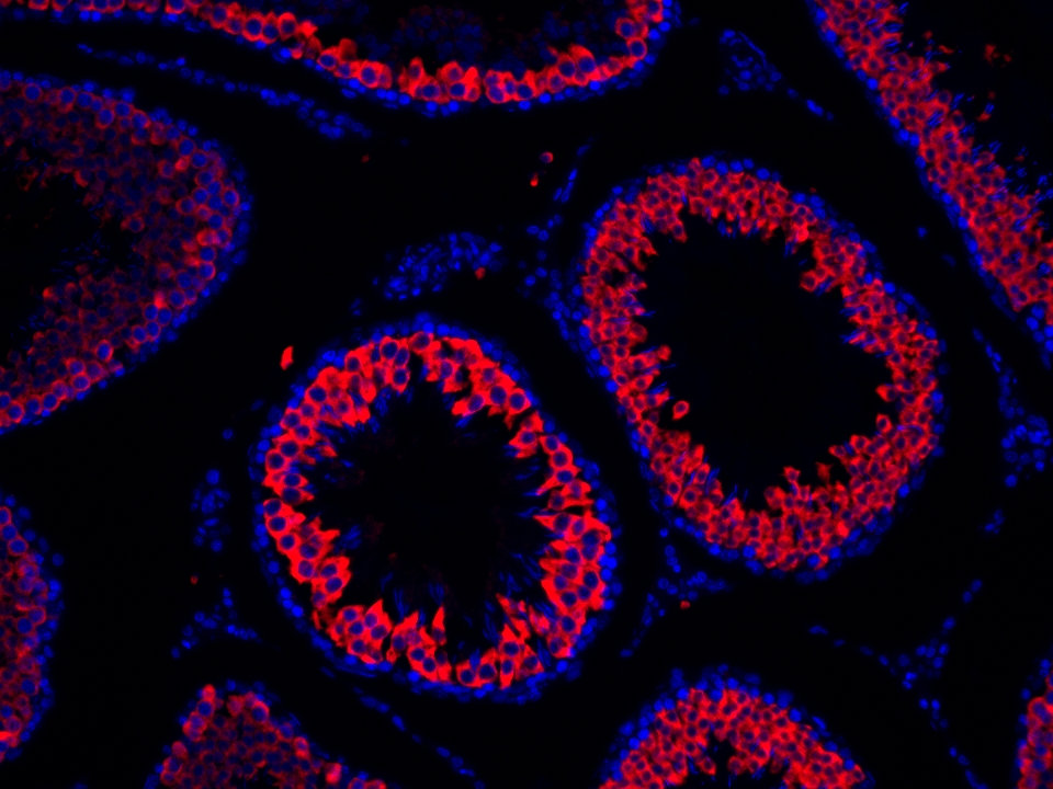 IF Staining using CoraLite®Plus 594-Tyramide Reagent PR30024. 
FFPE-rat testis tissue was stained with 13720-1-AP (BOULE polyclonal antibody) at 1:2000 followed by detection with Multi-rAb® Polymer HRP-Goat Anti-Rabbit/Mouse Universal Recombinant Secondary Antibody (H+L) (Cat.NO. RGAU011). CoraLite®Plus 594-Tyramide Reagent (Cat.NO. PR30024) was used for signal development. Cell nucleus (blue) was stained with DAPI. IF Staining using CoraLite®Plus 594-Tyramide Reagent PR30024. 
FFPE-rat testis tissue was stained with 13720-1-AP (BOULE polyclonal antibody) at 1:2000 followed by detection with Multi-rAb® Polymer HRP-Goat Anti-Rabbit/Mouse Universal Recombinant Secondary Antibody (H+L) (Cat.NO. RGAU011). CoraLite®Plus 594-Tyramide Reagent (Cat.NO. PR30024) was used for signal development. Cell nucleus (blue) was stained with DAPI.