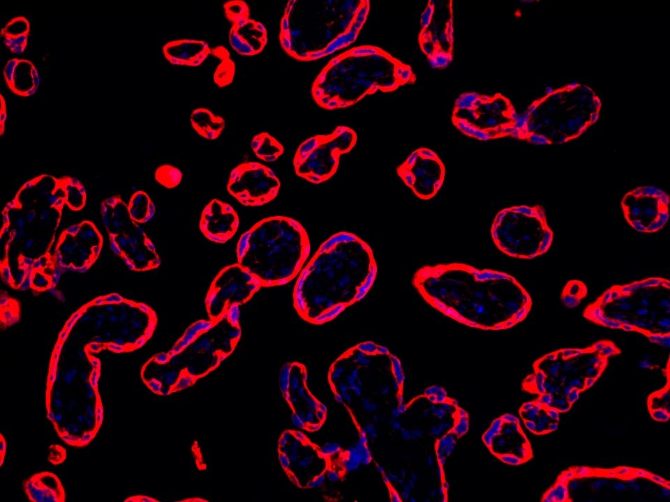 IF Staining using CoraLite®Plus 594-Tyramide Reagent PR30024. 
FFPE-human placenta tissue was stained with 30031-1-AP (SLC43A2 polyclonal antibody) at 1:500 followed by detection with Multi-rAb® Polymer HRP-Goat Anti-Rabbit/Mouse Universal Recombinant Secondary Antibody (H+L) (Cat.NO. RGAU011). CoraLite®Plus 594-Tyramide Reagent (Cat.NO. PR30024) was used for signal development. Cell nucleus (blue) was stained with DAPI. IF Staining using CoraLite®Plus 594-Tyramide Reagent PR30024. 
FFPE-human placenta tissue was stained with 30031-1-AP (SLC43A2 polyclonal antibody) at 1:500 followed by detection with Multi-rAb® Polymer HRP-Goat Anti-Rabbit/Mouse Universal Recombinant Secondary Antibody (H+L) (Cat.NO. RGAU011). CoraLite®Plus 594-Tyramide Reagent (Cat.NO. PR30024) was used for signal development. Cell nucleus (blue) was stained with DAPI.