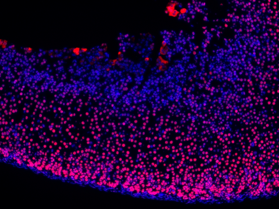 IF Staining using CoraLite®Plus 594-Tyramide Reagent PR30024. 
FFPE-mouse adrenal gland tissue was stained with 82979-6-RR (ARID1B Recombinant antibody) at 1:16000 followed by detection with Multi-rAb® Polymer HRP-Goat Anti-Rabbit/Mouse Universal Recombinant Secondary Antibody (H+L) (Cat.NO. RGAU011). CoraLite®Plus 594-Tyramide Reagent (Cat.NO. PR30024) was used for signal development. Cell nucleus (blue) was stained with DAPI. IF Staining using CoraLite®Plus 594-Tyramide Reagent PR30024. 
FFPE-mouse adrenal gland tissue was stained with 82979-6-RR (ARID1B Recombinant antibody) at 1:16000 followed by detection with Multi-rAb® Polymer HRP-Goat Anti-Rabbit/Mouse Universal Recombinant Secondary Antibody (H+L) (Cat.NO. RGAU011). CoraLite®Plus 594-Tyramide Reagent (Cat.NO. PR30024) was used for signal development. Cell nucleus (blue) was stained with DAPI.