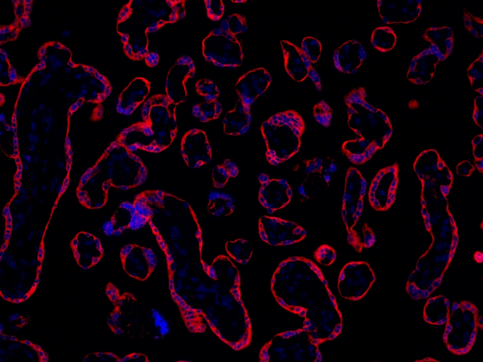 IF Staining using CoraLite®Plus 594-Tyramide Reagent PR30024. 
FFPE-human placenta tissue was stained with 83755-2-RR (RNF139 Recombinant antibody) at 1:2000 followed by detection with Multi-rAb® Polymer HRP-Goat Anti-Rabbit/Mouse Universal Recombinant Secondary Antibody (H+L) (Cat.NO. RGAU011). CoraLite®Plus 594-Tyramide Reagent (Cat.NO. PR30024) was used for signal development. Cell nucleus (blue) was stained with DAPI. IF Staining using CoraLite®Plus 594-Tyramide Reagent PR30024. 
FFPE-human placenta tissue was stained with 83755-2-RR (RNF139 Recombinant antibody) at 1:2000 followed by detection with Multi-rAb® Polymer HRP-Goat Anti-Rabbit/Mouse Universal Recombinant Secondary Antibody (H+L) (Cat.NO. RGAU011). CoraLite®Plus 594-Tyramide Reagent (Cat.NO. PR30024) was used for signal development. Cell nucleus (blue) was stained with DAPI.