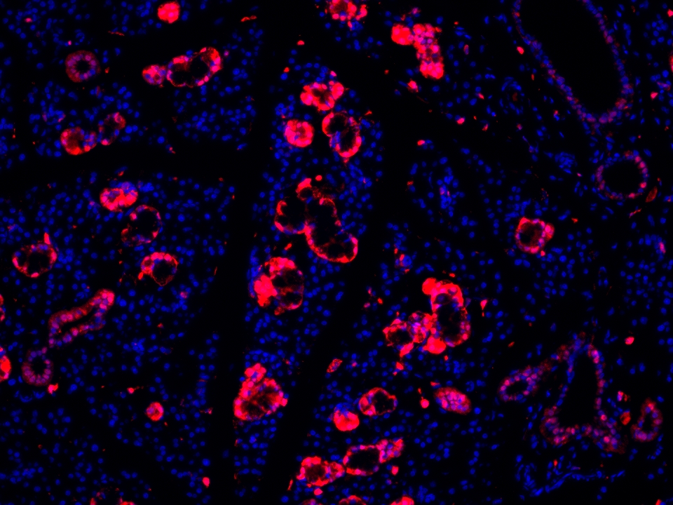 IF Staining using CoraLite®Plus 594-Tyramide Reagent PR30024. 
FFPE-rat salivary gland tissue was stained with 83356-5-RR (DUSP6 Recombinant antibody) at 1:1000 followed by detection with Multi-rAb® Polymer HRP-Goat Anti-Rabbit/Mouse Universal Recombinant Secondary Antibody (H+L) (Cat.NO. RGAU011). CoraLite®Plus 594-Tyramide Reagent (Cat.NO. PR30024) was used for signal development. Cell nucleus (blue) was stained with DAPI. IF Staining using CoraLite®Plus 594-Tyramide Reagent PR30024. 
FFPE-rat salivary gland tissue was stained with 83356-5-RR (DUSP6 Recombinant antibody) at 1:1000 followed by detection with Multi-rAb® Polymer HRP-Goat Anti-Rabbit/Mouse Universal Recombinant Secondary Antibody (H+L) (Cat.NO. RGAU011). CoraLite®Plus 594-Tyramide Reagent (Cat.NO. PR30024) was used for signal development. Cell nucleus (blue) was stained with DAPI.
