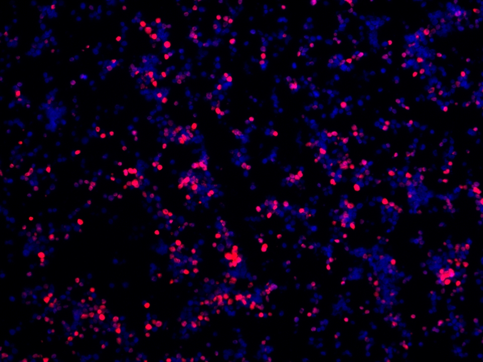 IF Staining using CoraLite®Plus 594-Tyramide Reagent PR30024. 
FFPE-MJ cells was stained with 68803-2-Ig (FOXP3 Monoclonal antibody) at 1:2000 followed by detection with Multi-rAb® Polymer HRP-Goat Anti-Rabbit/Mouse Universal Recombinant Secondary Antibody (H+L) (Cat.NO. RGAU011). CoraLite®Plus 594-Tyramide Reagent (Cat.NO. PR30024) was used for signal development. Cell nucleus (blue) was stained with DAPI.  IF Staining using CoraLite®Plus 594-Tyramide Reagent PR30024. 
FFPE-MJ cells was stained with 68803-2-Ig (FOXP3 Monoclonal antibody) at 1:2000 followed by detection with Multi-rAb® Polymer HRP-Goat Anti-Rabbit/Mouse Universal Recombinant Secondary Antibody (H+L) (Cat.NO. RGAU011). CoraLite®Plus 594-Tyramide Reagent (Cat.NO. PR30024) was used for signal development. Cell nucleus (blue) was stained with DAPI.