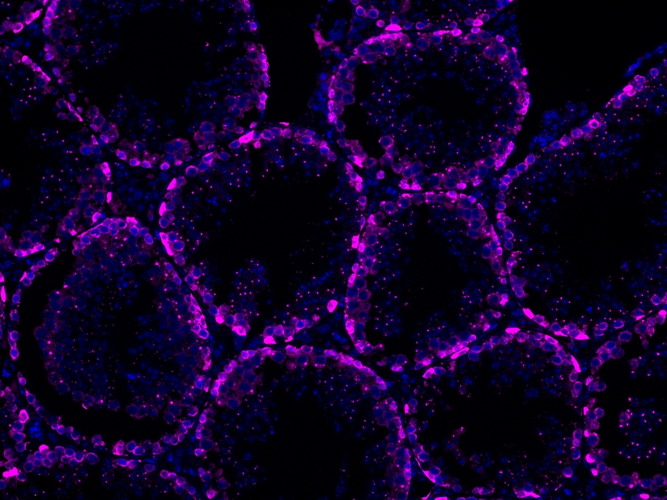 IF Staining using CoraLite®Plus 647-Tyramide Reagent PR30025. 
FFPE-mouse testis tissue was stained with 26718-1-AP (DUSP9 polyclonal antibody) at 1:500 followed by detection of Multi-rAb® Polymer HRP-Goat Anti-Rabbit/Mouse Universal Recombinant Secondary Antibody (H+L) (Cat.NO. RGAU011). CoraLite®Plus 647-Tyramide Reagent (Cat.NO. PR30025) was used for signal development. Cell nucleus (blue) was stained with DAPI. IF Staining using CoraLite®Plus 647-Tyramide Reagent PR30025. 
FFPE-mouse testis tissue was stained with 26718-1-AP (DUSP9 polyclonal antibody) at 1:500 followed by detection of Multi-rAb® Polymer HRP-Goat Anti-Rabbit/Mouse Universal Recombinant Secondary Antibody (H+L) (Cat.NO. RGAU011). CoraLite®Plus 647-Tyramide Reagent (Cat.NO. PR30025) was used for signal development. Cell nucleus (blue) was stained with DAPI.