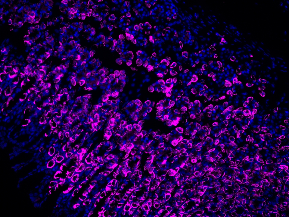 IF Staining using CoraLite®Plus 647-Tyramide Reagent PR30025. 
FFPE-rat stomach tissue was stained with 10182-1-AP (DCTN5 polyclonal antibody) at 1:200 followed by detection of Multi-rAb® Polymer HRP-Goat Anti-Rabbit/Mouse Universal Recombinant Secondary Antibody (H+L) (Cat.NO. RGAU011). CoraLite®Plus 647-Tyramide Reagent (Cat.NO. PR30025) was used for signal development. Cell nucleus (blue) was stained with DAPI. IF Staining using CoraLite®Plus 647-Tyramide Reagent PR30025. 
FFPE-rat stomach tissue was stained with 10182-1-AP (DCTN5 polyclonal antibody) at 1:200 followed by detection of Multi-rAb® Polymer HRP-Goat Anti-Rabbit/Mouse Universal Recombinant Secondary Antibody (H+L) (Cat.NO. RGAU011). CoraLite®Plus 647-Tyramide Reagent (Cat.NO. PR30025) was used for signal development. Cell nucleus (blue) was stained with DAPI.