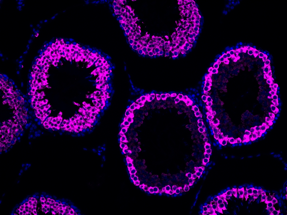 IF Staining using CoraLite®Plus 647-Tyramide Reagent PR30025. 
FFPE-rat testis tissue was stained with 13720-1-AP (BOULE polyclonal antibody) at 1:2000 followed by detection of Multi-rAb® Polymer HRP-Goat Anti-Rabbit/Mouse Universal Recombinant Secondary Antibody (H+L) (Cat.NO. RGAU011). CoraLite®Plus 647-Tyramide Reagent (Cat.NO. PR30025) was used for signal development. Cell nucleus (blue) was stained with DAPI. IF Staining using CoraLite®Plus 647-Tyramide Reagent PR30025. 
FFPE-rat testis tissue was stained with 13720-1-AP (BOULE polyclonal antibody) at 1:2000 followed by detection of Multi-rAb® Polymer HRP-Goat Anti-Rabbit/Mouse Universal Recombinant Secondary Antibody (H+L) (Cat.NO. RGAU011). CoraLite®Plus 647-Tyramide Reagent (Cat.NO. PR30025) was used for signal development. Cell nucleus (blue) was stained with DAPI.