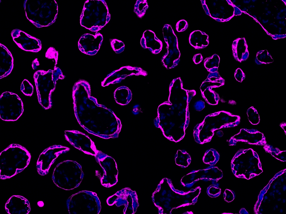 IF Staining using CoraLite®Plus 647-Tyramide Reagent PR30025. 
FFPE-human placenta tissue was stained with 30031-1-AP (SLC43A2 polyclonal antibody) at 1:500 followed by detection of Multi-rAb® Polymer HRP-Goat Anti-Rabbit/Mouse Universal Recombinant Secondary Antibody (H+L) (Cat.NO. RGAU011). CoraLite®Plus 647-Tyramide Reagent (Cat.NO. PR30025) was used for signal development. Cell nucleus (blue) was stained with DAPI. IF Staining using CoraLite®Plus 647-Tyramide Reagent PR30025. 
FFPE-human placenta tissue was stained with 30031-1-AP (SLC43A2 polyclonal antibody) at 1:500 followed by detection of Multi-rAb® Polymer HRP-Goat Anti-Rabbit/Mouse Universal Recombinant Secondary Antibody (H+L) (Cat.NO. RGAU011). CoraLite®Plus 647-Tyramide Reagent (Cat.NO. PR30025) was used for signal development. Cell nucleus (blue) was stained with DAPI.
