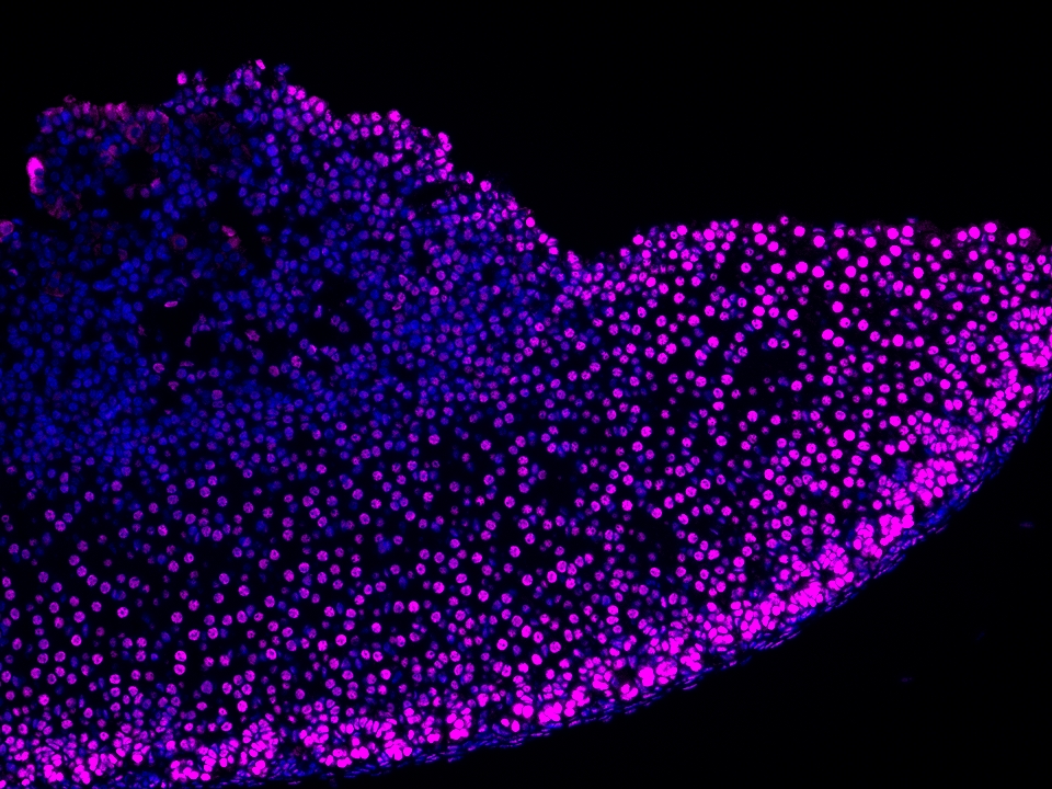 IF Staining using CoraLite®Plus 647-Tyramide Reagent PR30025. 
FFPE-mouse adrenal gland tissue was stained with 82979-6-RR (ARID1B Recombinant antibody) at 1:16000 followed by detection of Multi-rAb® Polymer HRP-Goat Anti-Rabbit/Mouse Universal Recombinant Secondary Antibody (H+L) (Cat.NO. RGAU011). CoraLite®Plus 647-Tyramide Reagent (Cat.NO. PR30025) was used for signal development. Cell nucleus (blue) was stained with DAPI. IF Staining using CoraLite®Plus 647-Tyramide Reagent PR30025. 
FFPE-mouse adrenal gland tissue was stained with 82979-6-RR (ARID1B Recombinant antibody) at 1:16000 followed by detection of Multi-rAb® Polymer HRP-Goat Anti-Rabbit/Mouse Universal Recombinant Secondary Antibody (H+L) (Cat.NO. RGAU011). CoraLite®Plus 647-Tyramide Reagent (Cat.NO. PR30025) was used for signal development. Cell nucleus (blue) was stained with DAPI.