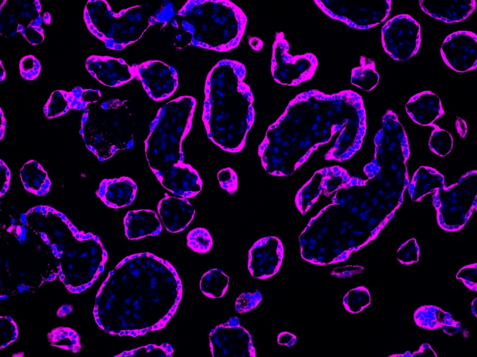 IF Staining using CoraLite®Plus 647-Tyramide Reagent PR30025. 
FFPE-human placenta tissue was stained with 83755-2-RR (RNF139 Recombinant antibody) at 1:2000 followed by detection of Multi-rAb® Polymer HRP-Goat Anti-Rabbit/Mouse Universal Recombinant Secondary Antibody (H+L) (Cat.NO. RGAU011). CoraLite®Plus 647-Tyramide Reagent (Cat.NO. PR30025) was used for signal development. Cell nucleus (blue) was stained with DAPI. IF Staining using CoraLite®Plus 647-Tyramide Reagent PR30025. 
FFPE-human placenta tissue was stained with 83755-2-RR (RNF139 Recombinant antibody) at 1:2000 followed by detection of Multi-rAb® Polymer HRP-Goat Anti-Rabbit/Mouse Universal Recombinant Secondary Antibody (H+L) (Cat.NO. RGAU011). CoraLite®Plus 647-Tyramide Reagent (Cat.NO. PR30025) was used for signal development. Cell nucleus (blue) was stained with DAPI.