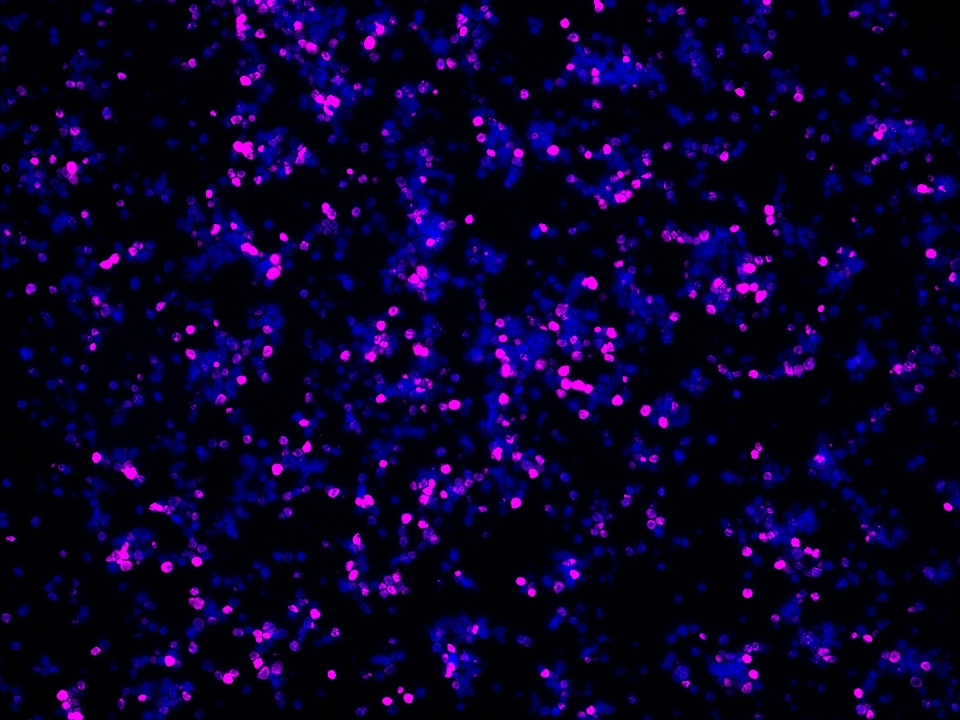 IF Staining using CoraLite®Plus 647-Tyramide Reagent PR30025. 
FFPE-MJ cells was stained with 68803-2-Ig (FOXP3 Monoclonal antibody) at 1:2000 followed by detection of Multi-rAb® Polymer HRP-Goat Anti-Rabbit/Mouse Universal Recombinant Secondary Antibody (H+L) (Cat.NO. RGAU011). CoraLite®Plus 647-Tyramide Reagent (Cat.NO. PR30025) was used for signal development. Cell nucleus (blue) was stained with DAPI. IF Staining using CoraLite®Plus 647-Tyramide Reagent PR30025. 
FFPE-MJ cells was stained with 68803-2-Ig (FOXP3 Monoclonal antibody) at 1:2000 followed by detection of Multi-rAb® Polymer HRP-Goat Anti-Rabbit/Mouse Universal Recombinant Secondary Antibody (H+L) (Cat.NO. RGAU011). CoraLite®Plus 647-Tyramide Reagent (Cat.NO. PR30025) was used for signal development. Cell nucleus (blue) was stained with DAPI.