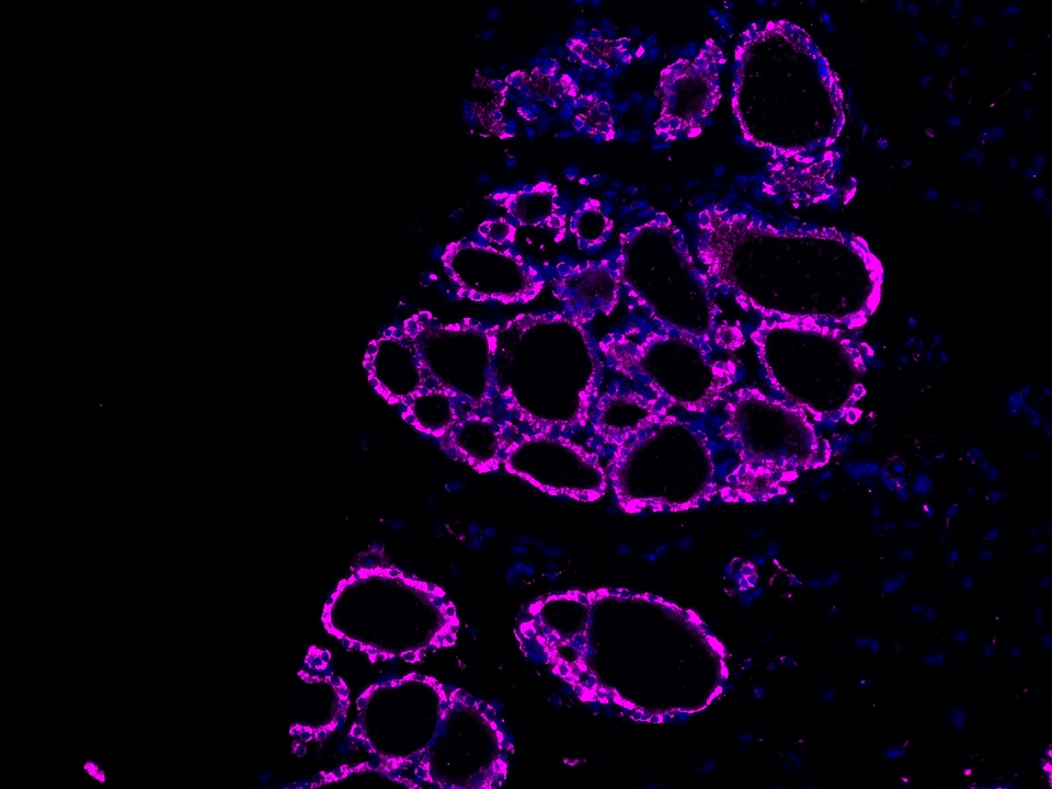 IF Staining using CoraLite®Plus 647-Tyramide Reagent PR30025. 
FFPE-rat thyroid gland tissue was stained with 24368-1-AP (RBM46 polyclonal antibody) at 1:500 followed by detection of Multi-rAb® Polymer HRP-Goat Anti-Rabbit/Mouse Universal Recombinant Secondary Antibody (H+L) (Cat.NO. RGAU011). CoraLite®Plus 647-Tyramide Reagent (Cat.NO. PR30025) was used for signal development. Cell nucleus (blue) was stained with DAPI.  IF Staining using CoraLite®Plus 647-Tyramide Reagent PR30025. 
FFPE-rat thyroid gland tissue was stained with 24368-1-AP (RBM46 polyclonal antibody) at 1:500 followed by detection of Multi-rAb® Polymer HRP-Goat Anti-Rabbit/Mouse Universal Recombinant Secondary Antibody (H+L) (Cat.NO. RGAU011). CoraLite®Plus 647-Tyramide Reagent (Cat.NO. PR30025) was used for signal development. Cell nucleus (blue) was stained with DAPI.