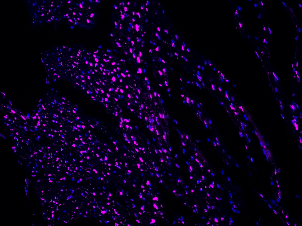 IF Staining using CoraLite®Plus 647-Tyramide Reagent PR30025. 
FFPE-mouse heart tissue was stained with 82962-1-RR (SNIP1 Recombinant antibody) at 1:500 followed by detection of Multi-rAb® Polymer HRP-Goat Anti-Rabbit/Mouse Universal Recombinant Secondary Antibody (H+L) (Cat.NO. RGAU011). CoraLite®Plus 647-Tyramide Reagent (Cat.NO. PR30025) was used for signal development. Cell nucleus (blue) was stained with DAPI. IF Staining using CoraLite®Plus 647-Tyramide Reagent PR30025. 
FFPE-mouse heart tissue was stained with 82962-1-RR (SNIP1 Recombinant antibody) at 1:500 followed by detection of Multi-rAb® Polymer HRP-Goat Anti-Rabbit/Mouse Universal Recombinant Secondary Antibody (H+L) (Cat.NO. RGAU011). CoraLite®Plus 647-Tyramide Reagent (Cat.NO. PR30025) was used for signal development. Cell nucleus (blue) was stained with DAPI.