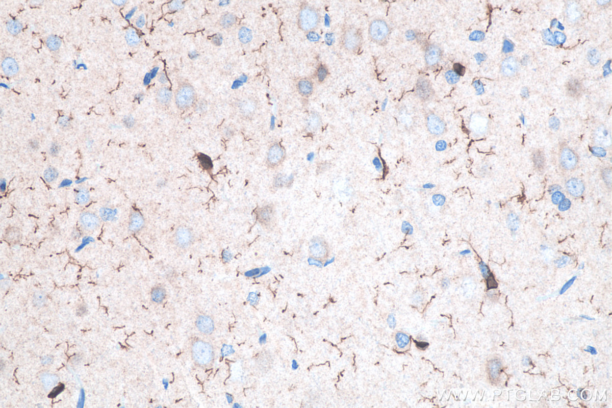 Immunohistochemical analysis of paraffin-embedded rat brain tissue slide using KHC0056 (IBA1 IHC Kit).