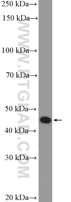 Mouse spinal cord tissue was subjected to SDS PAGE followed by western blot with 11976-1-AP (P2RY12 Antibody)